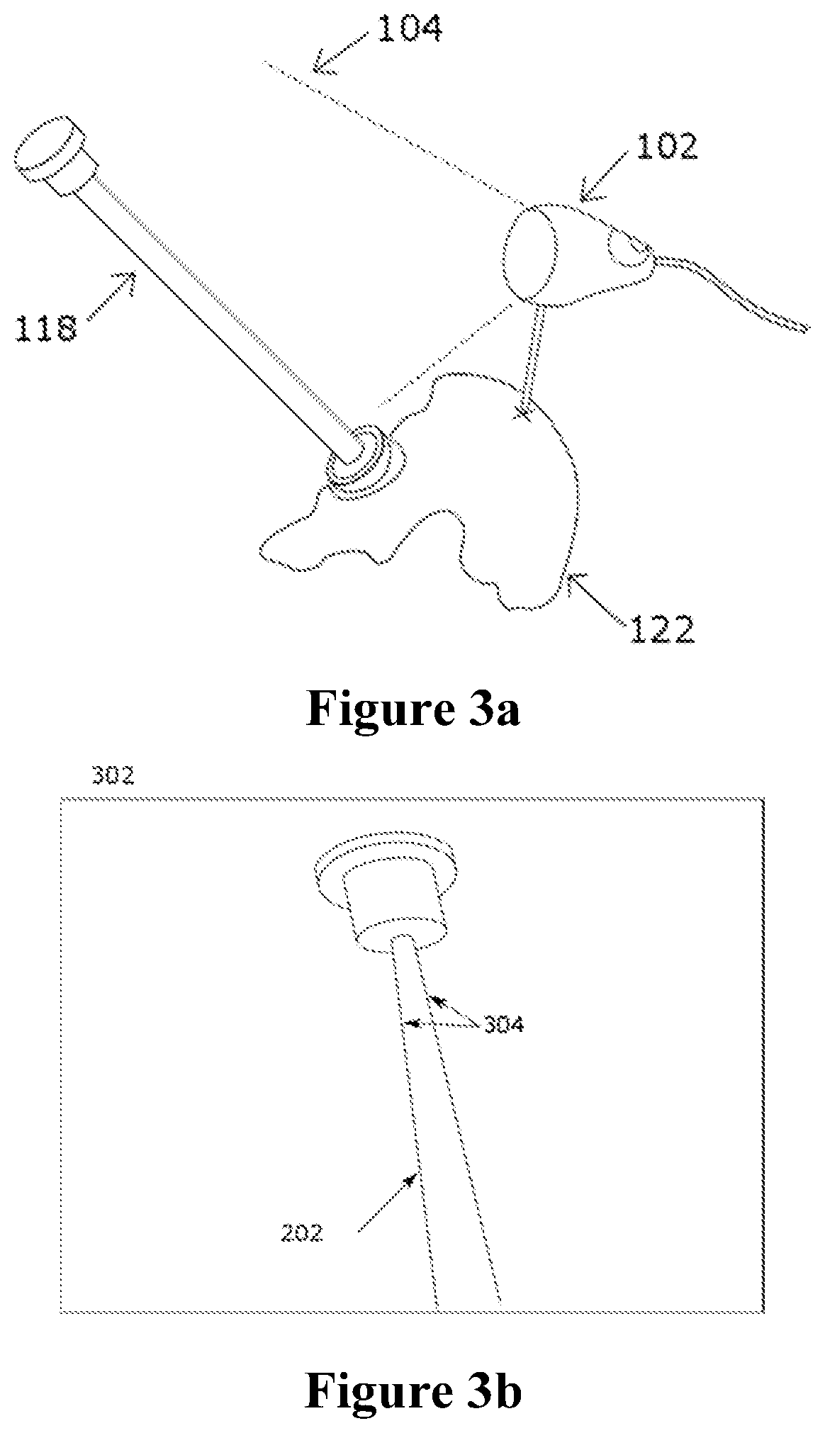 Patent US12588953 Figure 2 – Devices, systems and methods for natural feature tracking of surgical tools and other objects