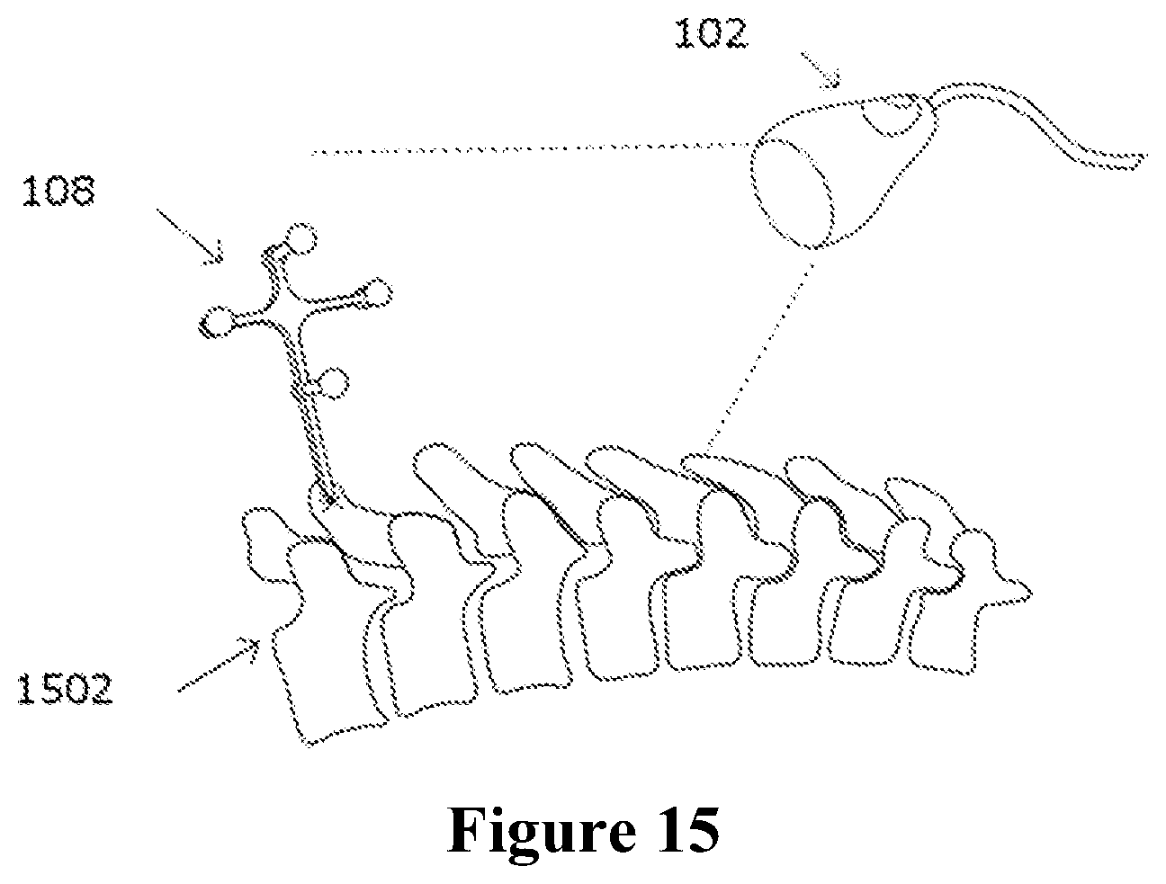 Patent US12588953 Figure 12 – Devices, systems and methods for natural feature tracking of surgical tools and other objects