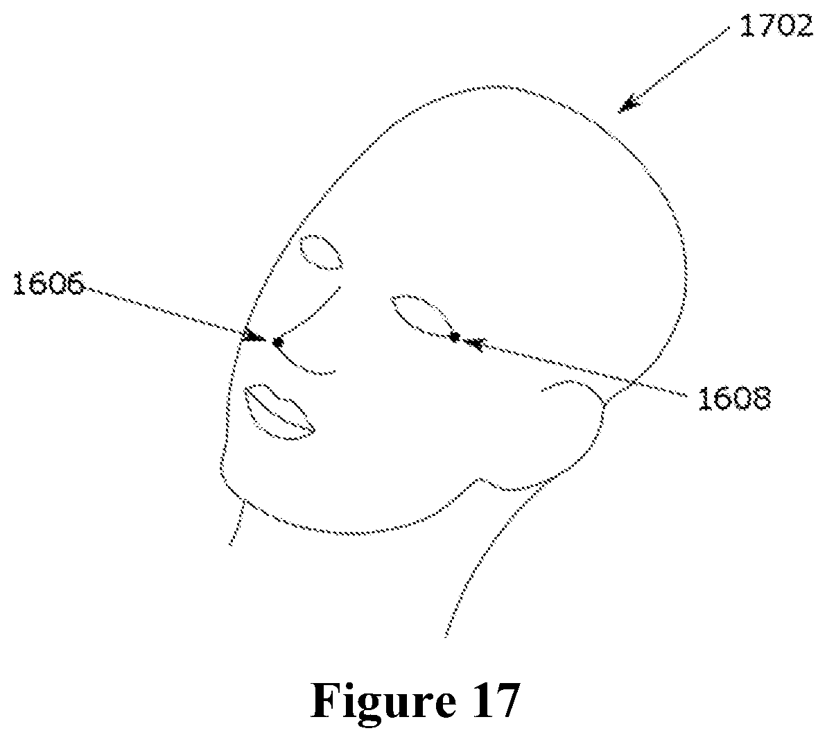 Patent US12588953 Figure 14 – Devices, systems and methods for natural feature tracking of surgical tools and other objects