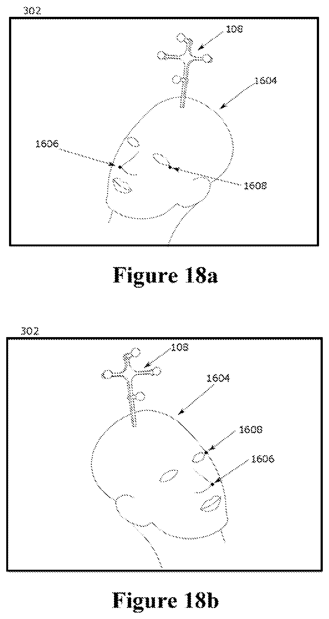 Patent US12588953 Figure 15 – Devices, systems and methods for natural feature tracking of surgical tools and other objects