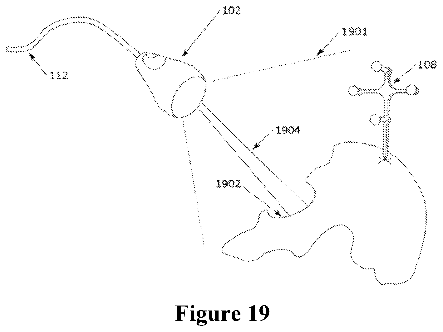 Patent US12588953 Figure 16 – Devices, systems and methods for natural feature tracking of surgical tools and other objects