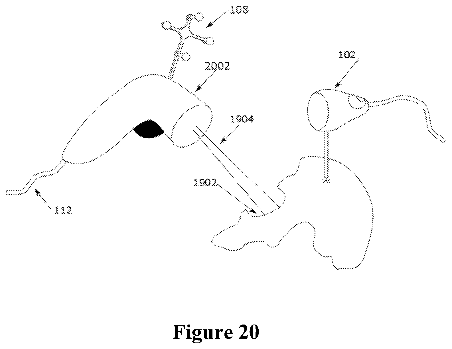 Patent US12588953 Figure 17 – Devices, systems and methods for natural feature tracking of surgical tools and other objects
