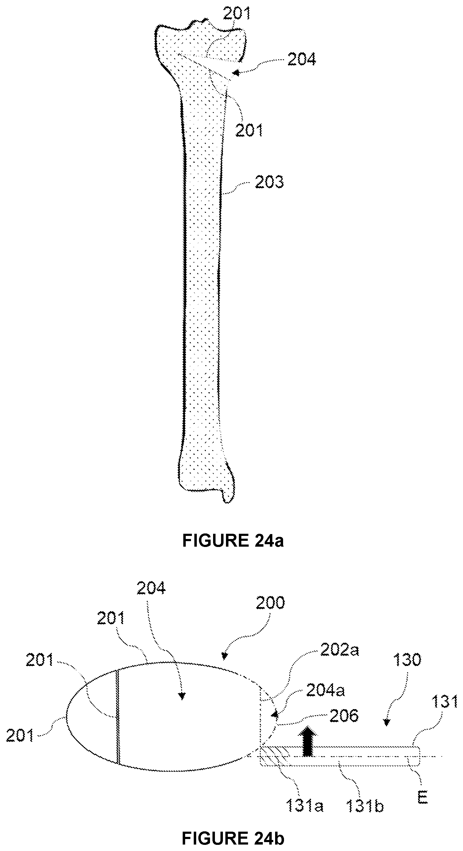 Patent US12588955 Figure 15 – Computer-assisted surgery system
