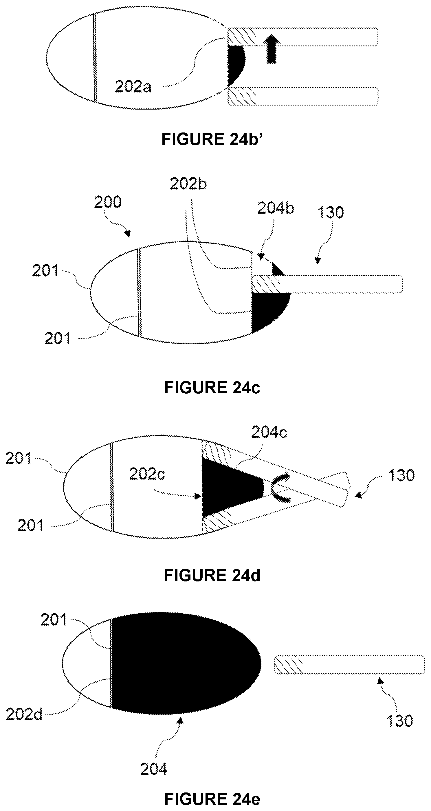 Patent US12588955 Figure 16 – Computer-assisted surgery system