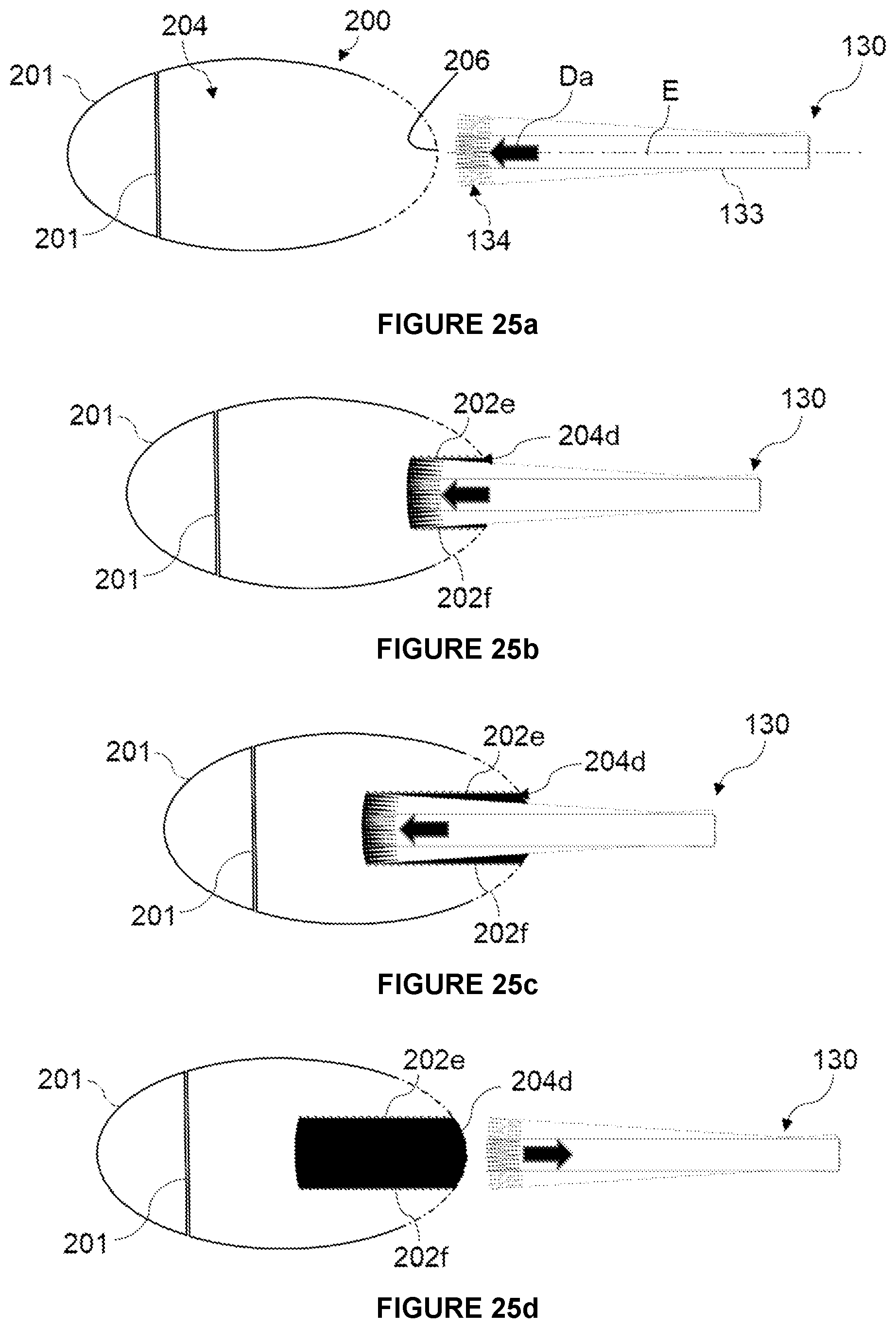 Patent US12588955 Figure 17 – Computer-assisted surgery system