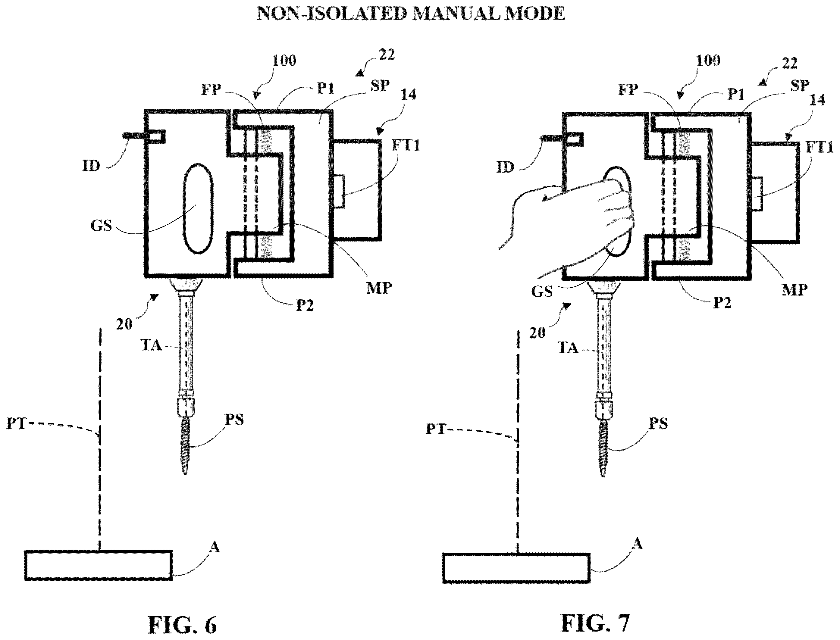 Patent US12588957 Figure 5 – Surgical robotic system with compliance mechanism