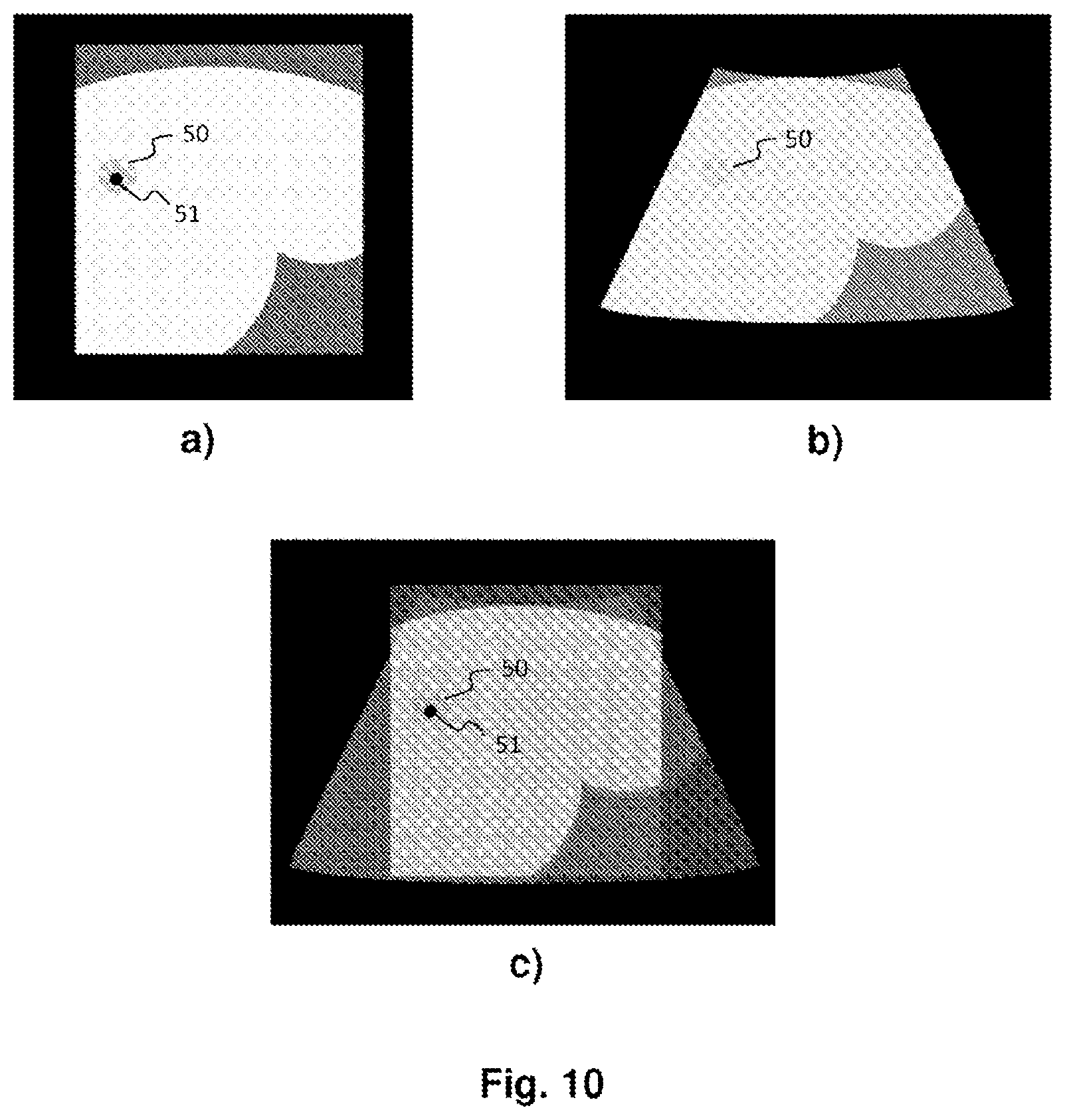 Patent US12588960 Figure 7 – Medical robot for placement of medical instruments under ultrasound guidance