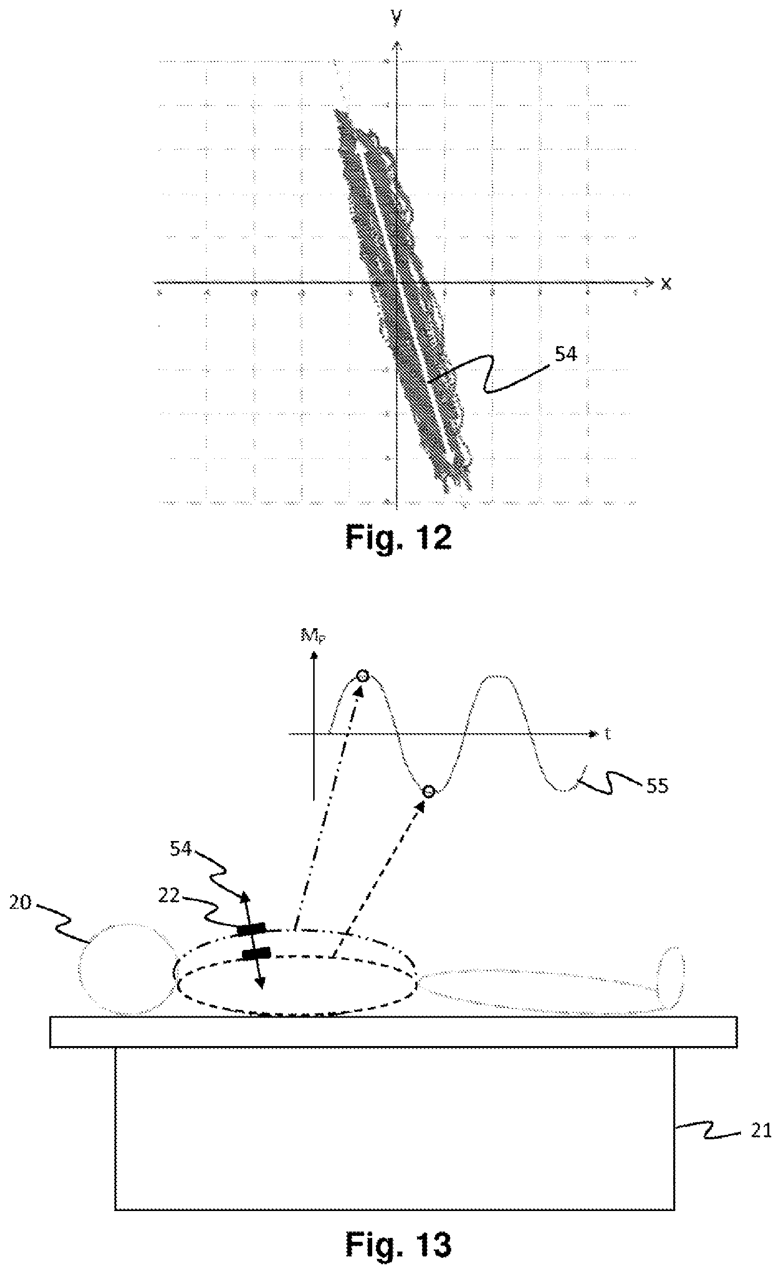 Patent US12588960 Figure 9 – Medical robot for placement of medical instruments under ultrasound guidance