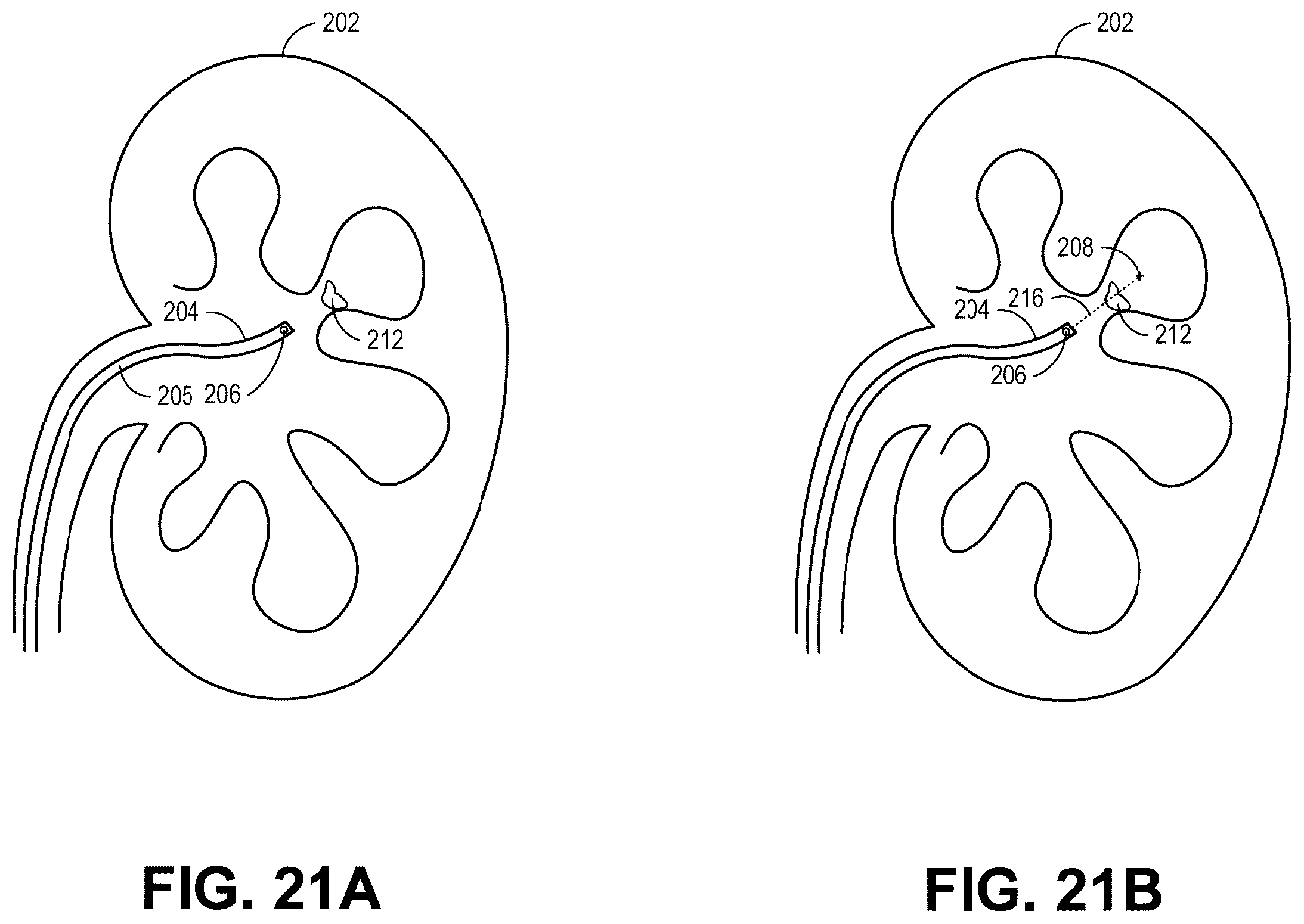 Patent US12588964 Figure 20 – Medical instrument guidance with robotic systems