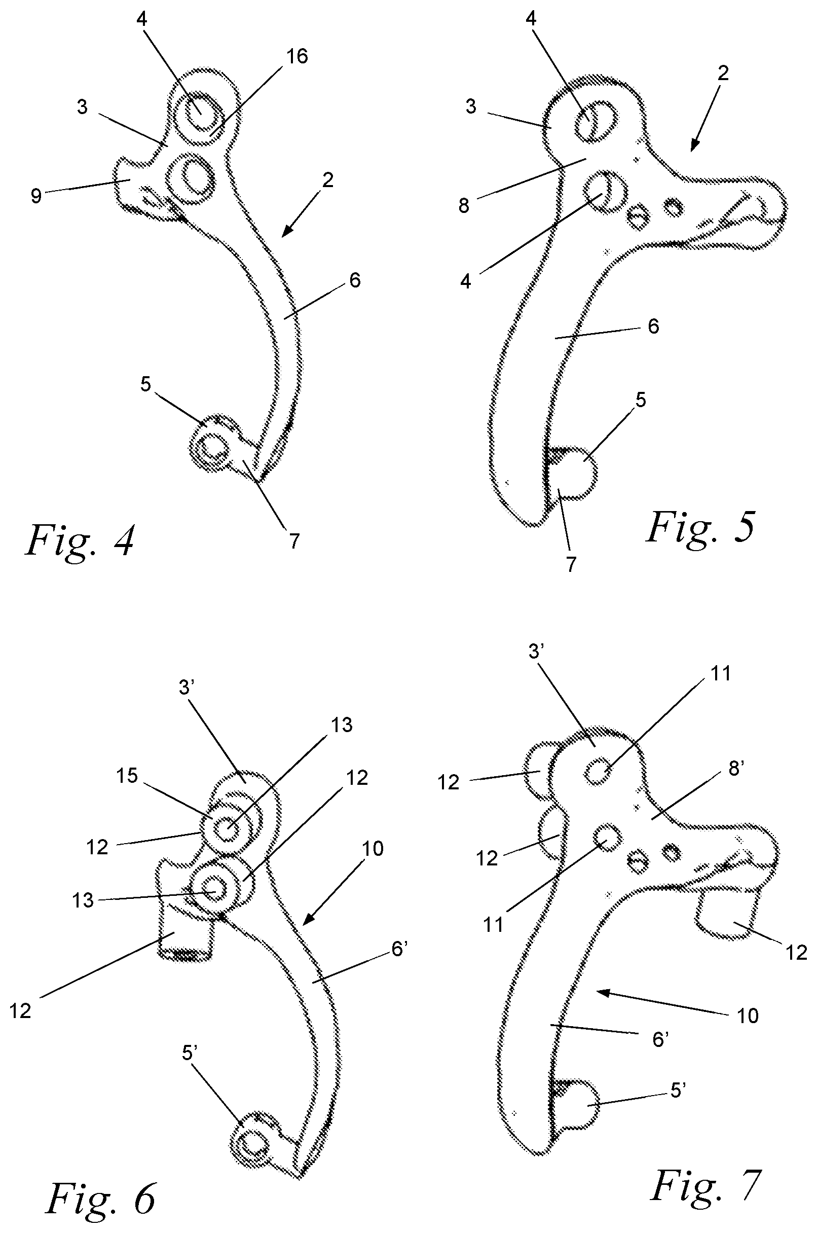 Patent US12588969 Figure 2 – Bone anchor for an upper or lower jaw with a corresponding drilling template