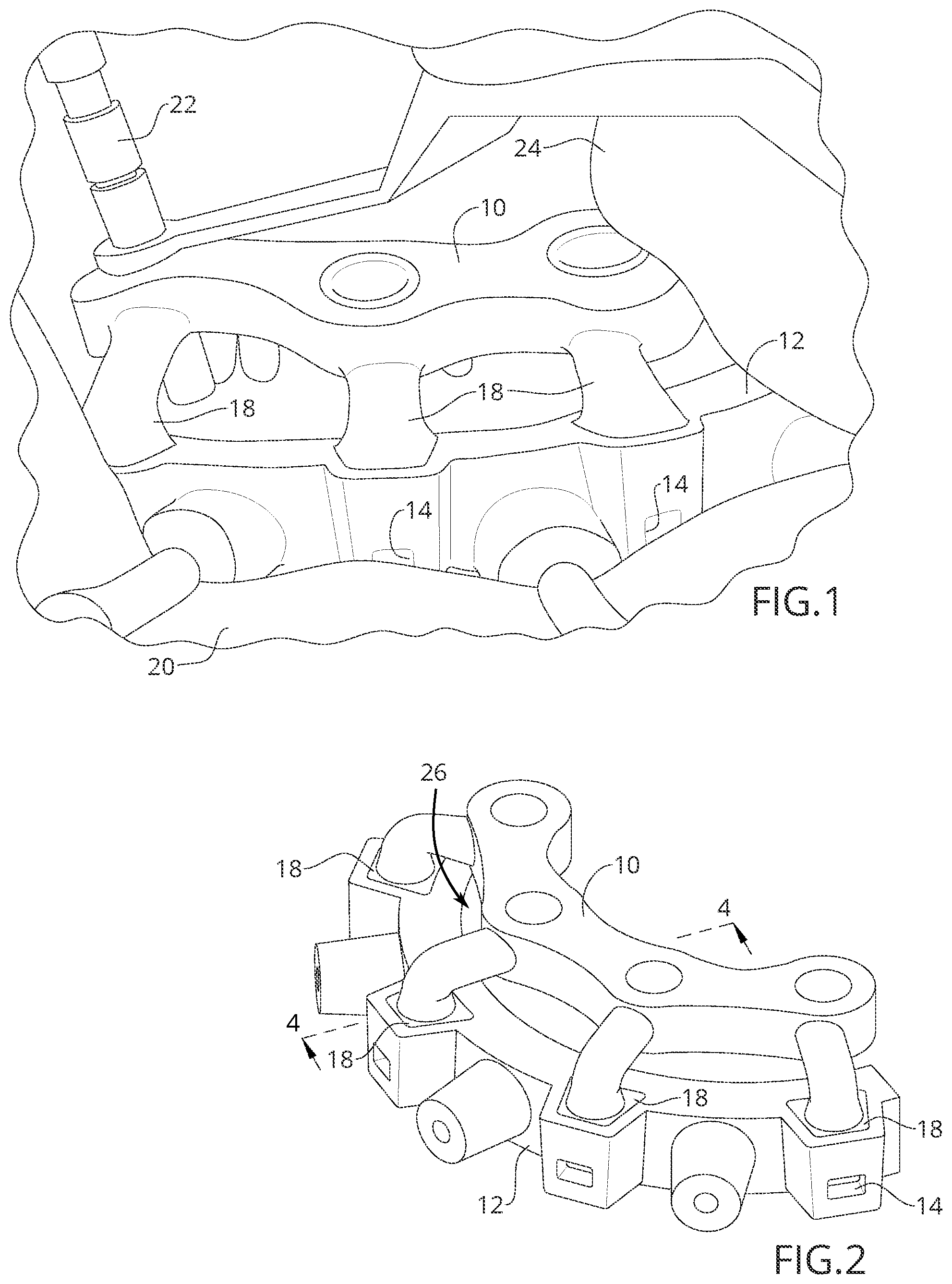 Patent US12588970 Figure 1 – Surgical guide with mating connectors