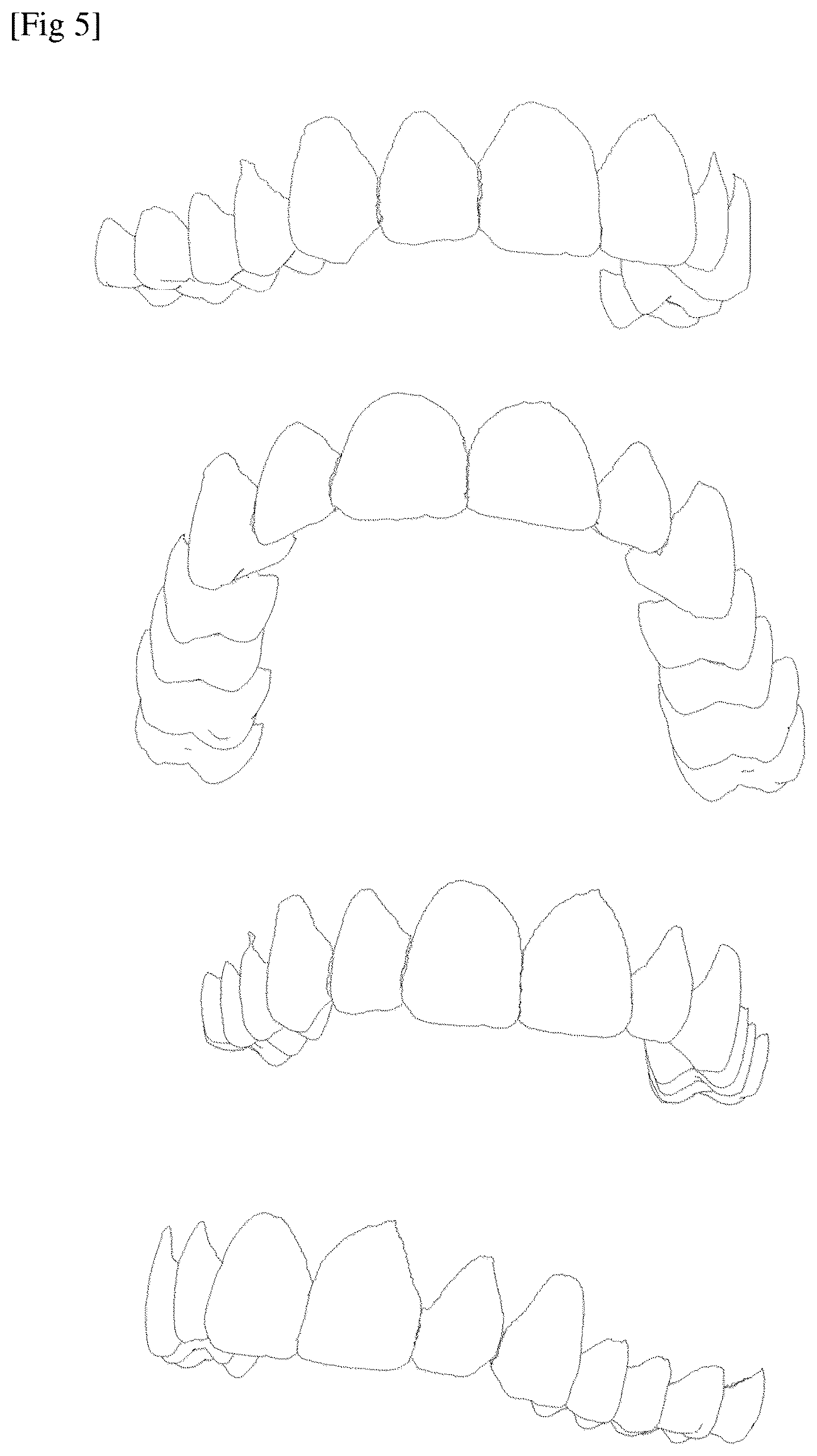 Patent US12588971 Figure 3 – Method for analyzing a dental situation of a patient