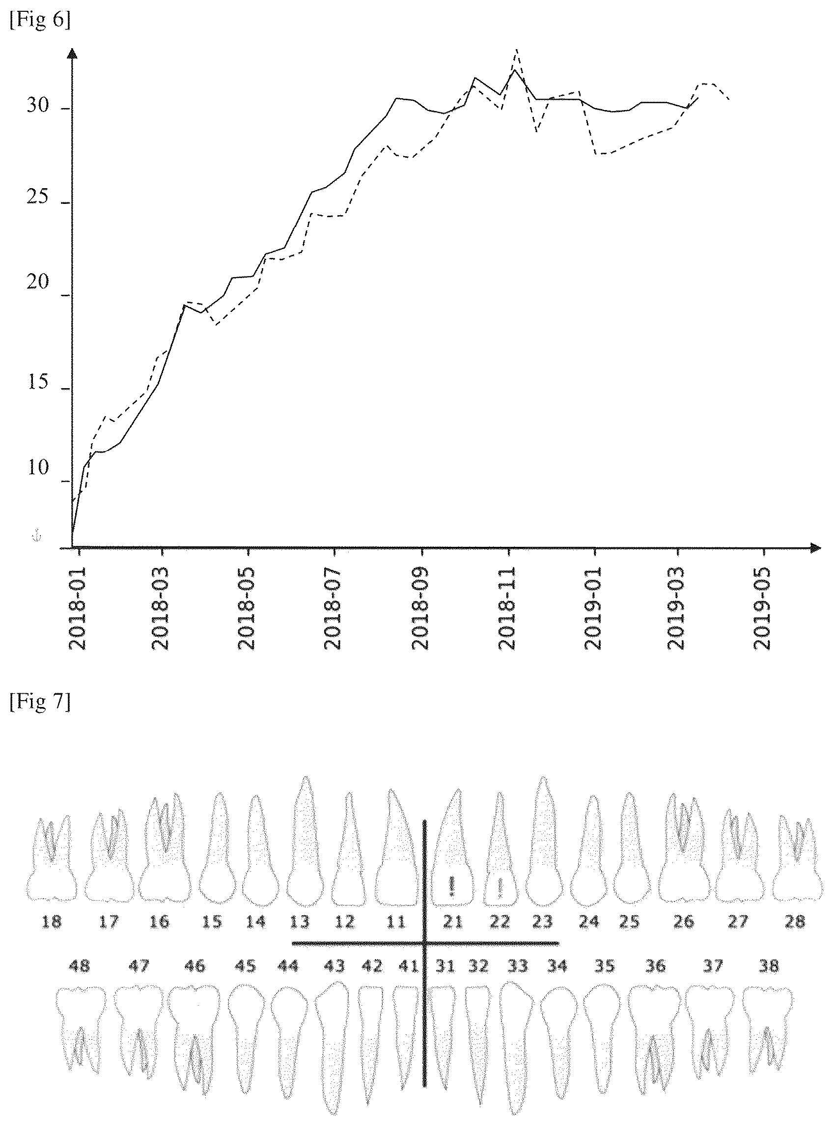 Patent US12588971 Figure 4 – Method for analyzing a dental situation of a patient