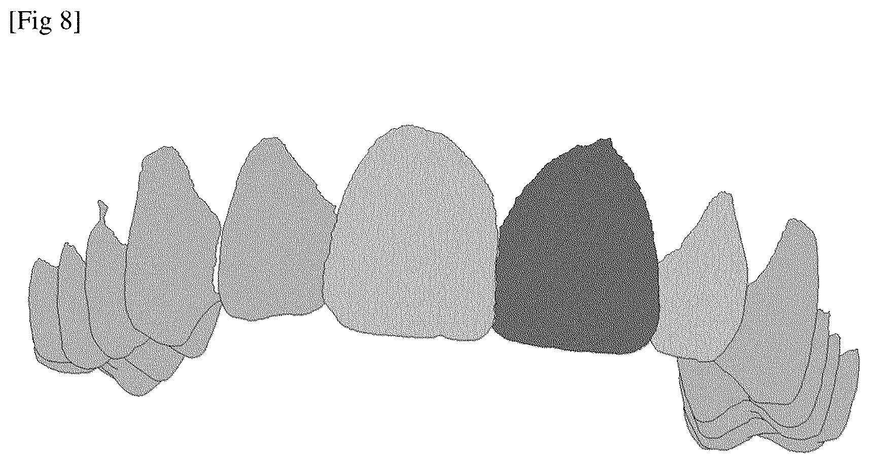 Patent US12588971 Figure 5 – Method for analyzing a dental situation of a patient