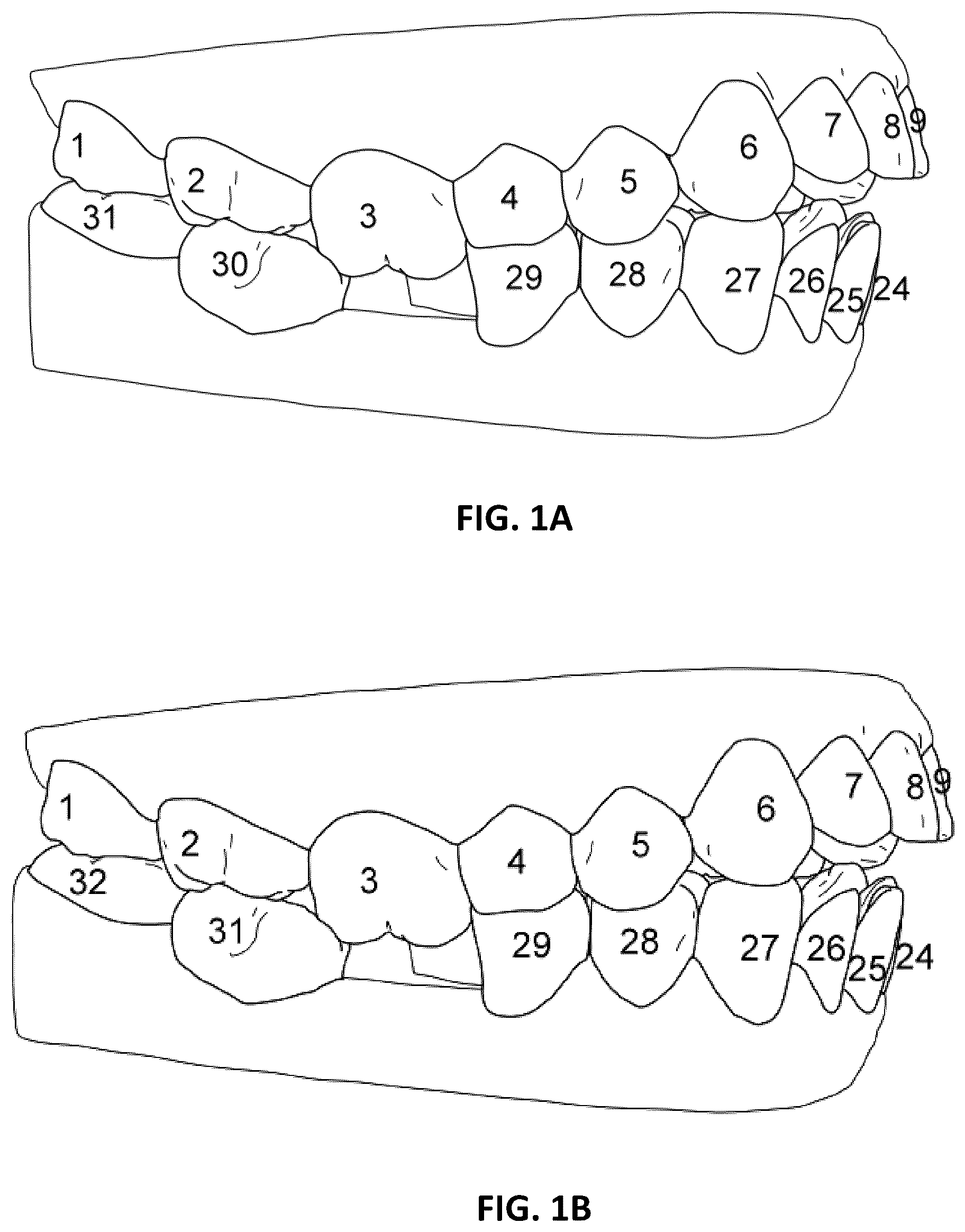 Patent US12588972 Figure 1 – Dental analysis with missing teeth prediction