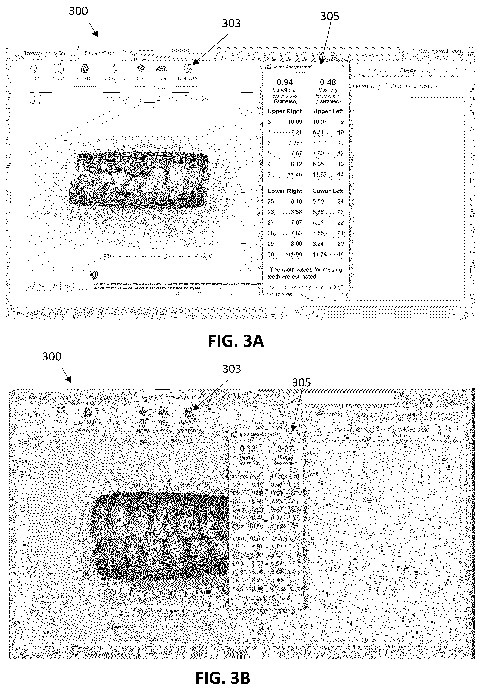 Patent US12588972 Figure 4 – Dental analysis with missing teeth prediction