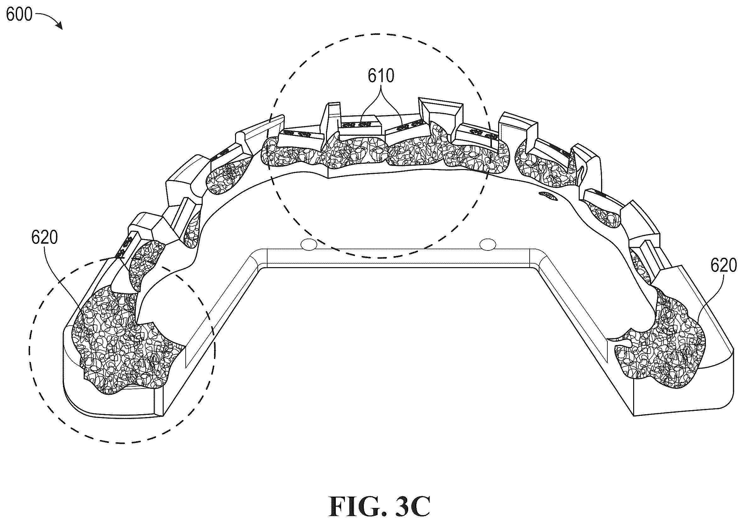 Patent US12588973 Figure 4 – Reduced registration bonding template