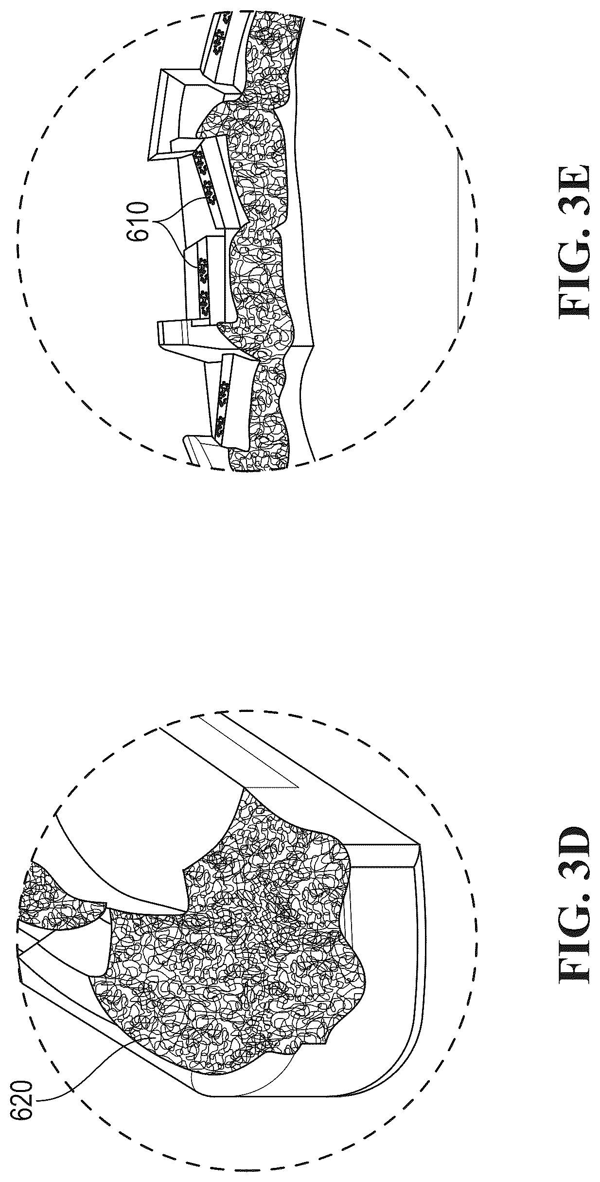 Patent US12588973 Figure 5 – Reduced registration bonding template