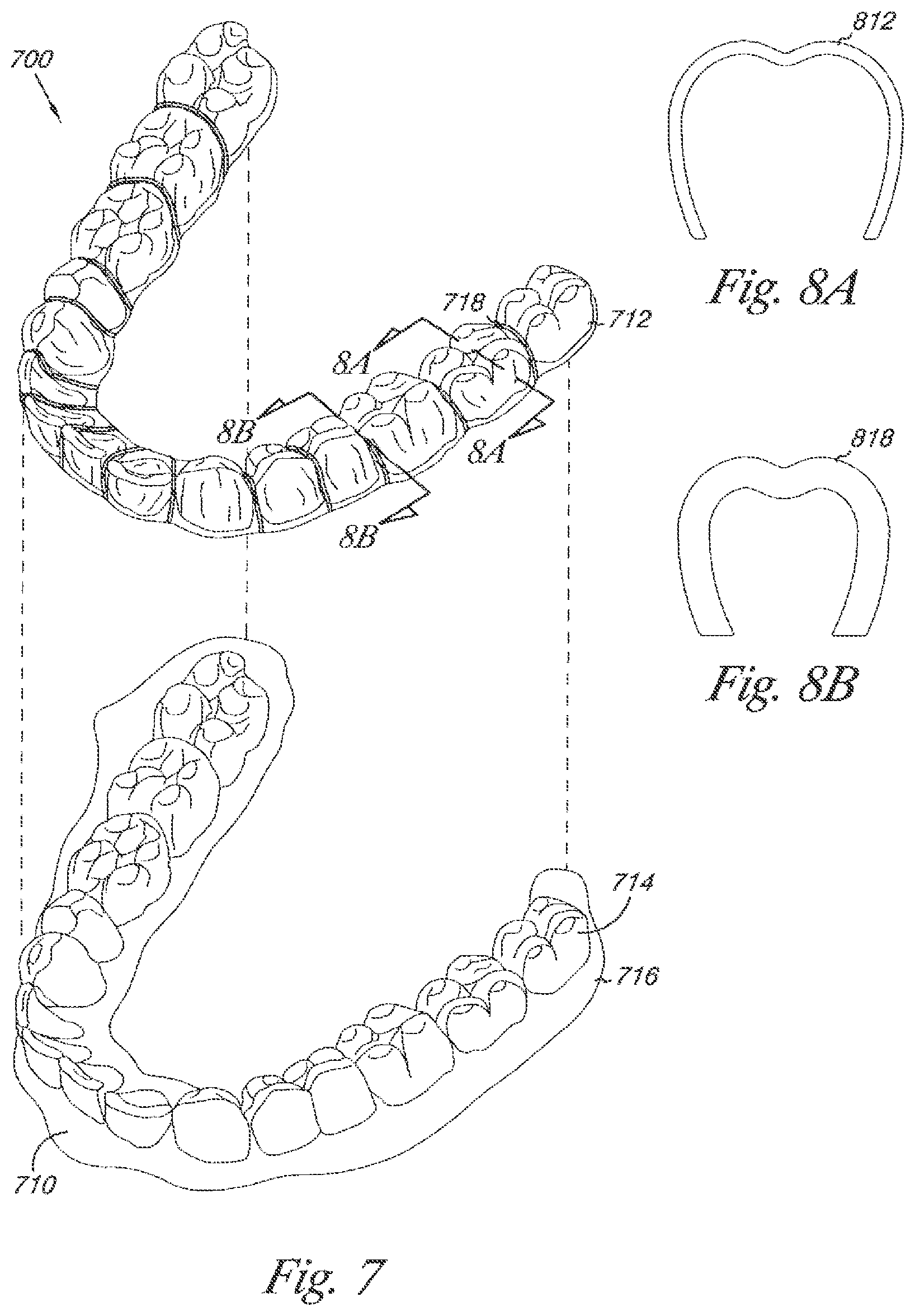 Patent US12588976 Figure 8 – Methods of forming dental appliances with reinforcement ribs