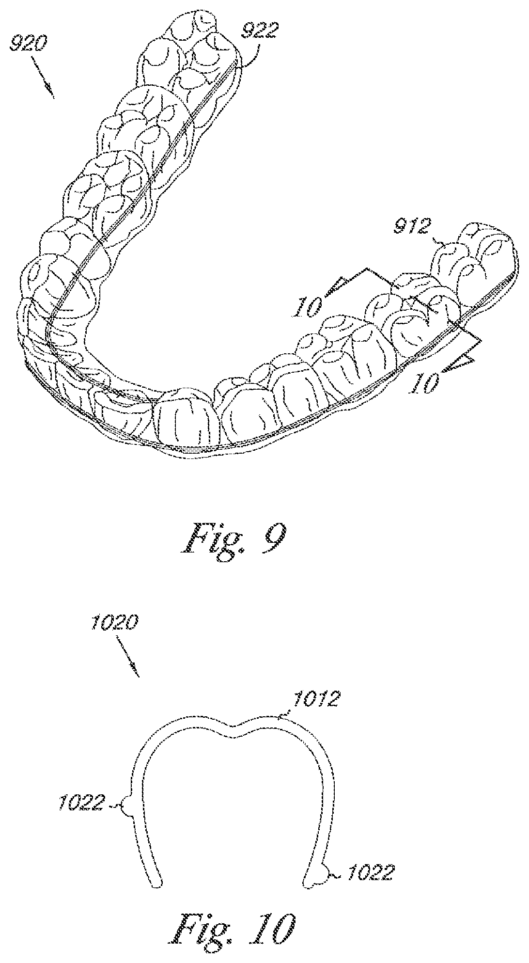 Patent US12588976 Figure 9 – Methods of forming dental appliances with reinforcement ribs