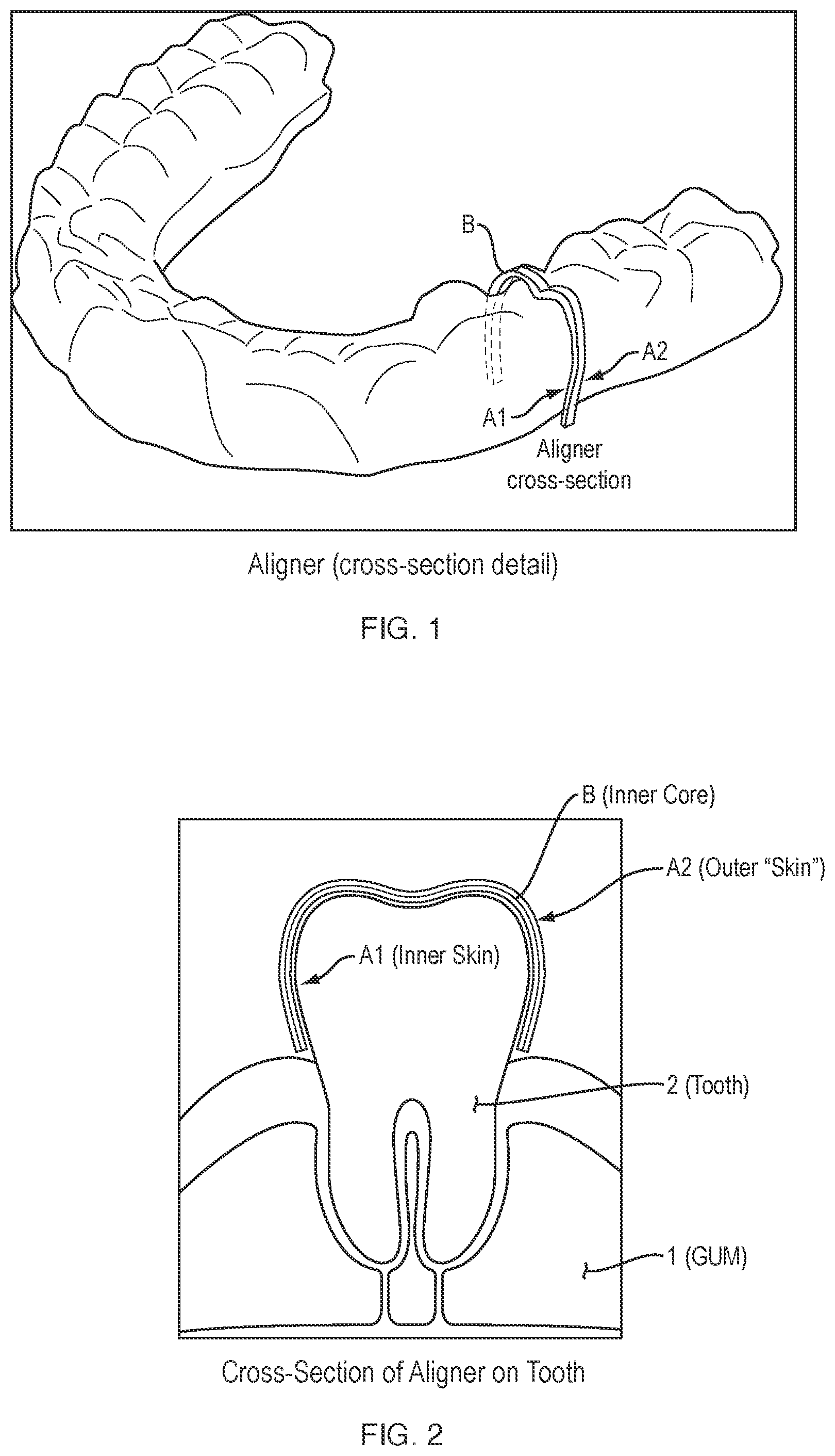 Patent US12588977 — Dental aligner — Figure 1