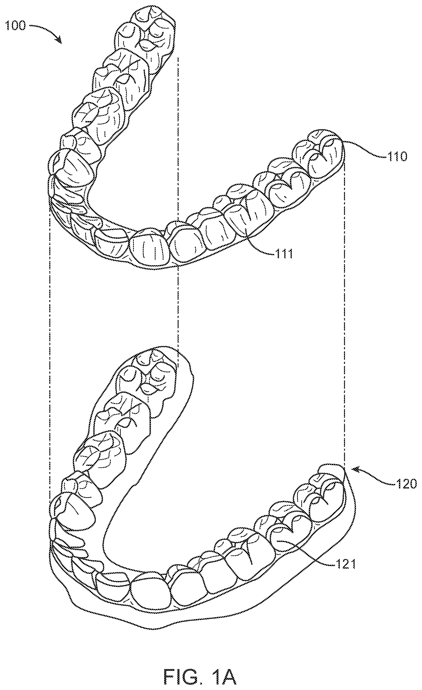 Patent US12588978 Figure 1 – Devices, systems, and methods for dental arch expansion