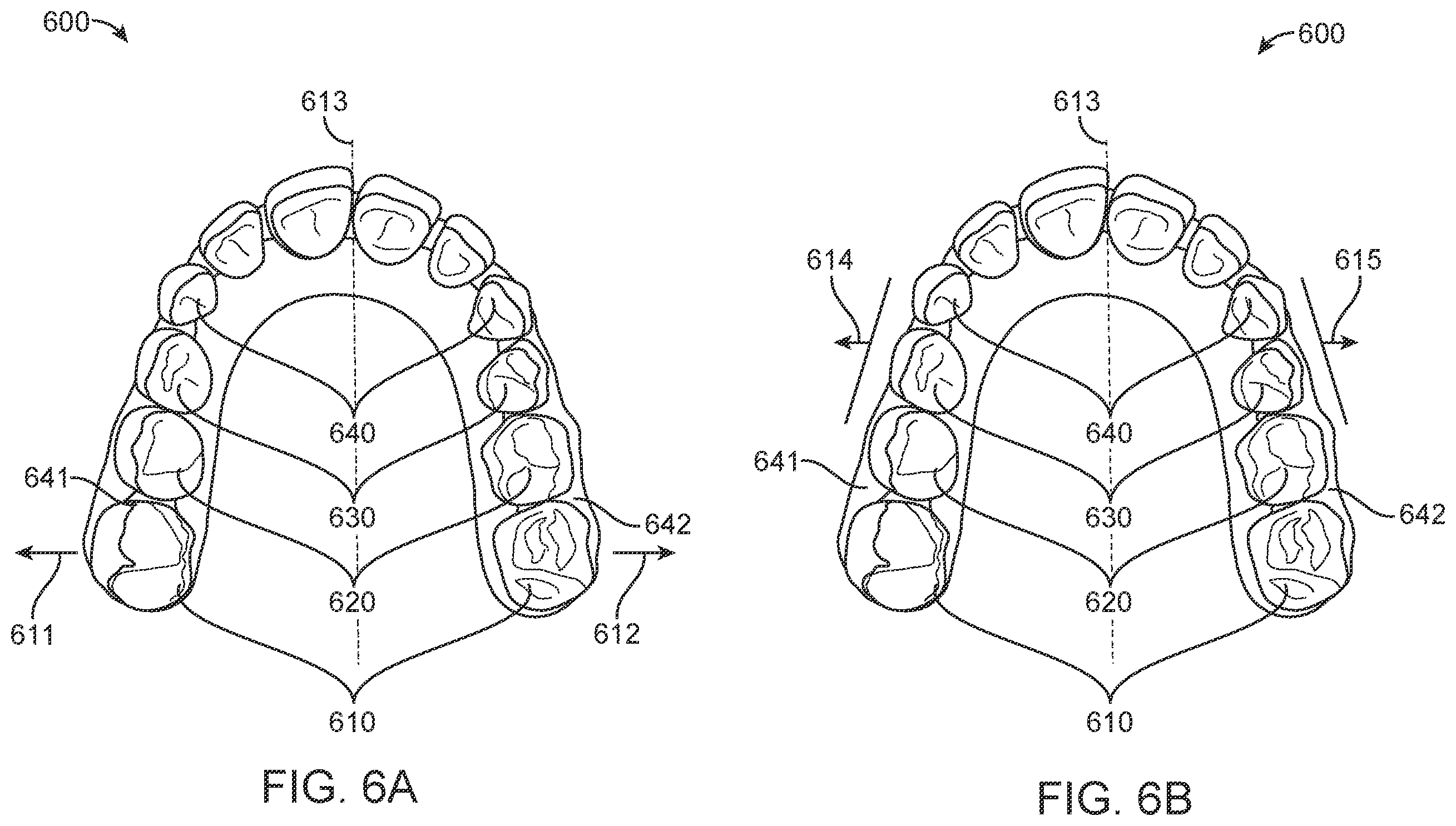 Patent US12588978 Figure 9 – Devices, systems, and methods for dental arch expansion