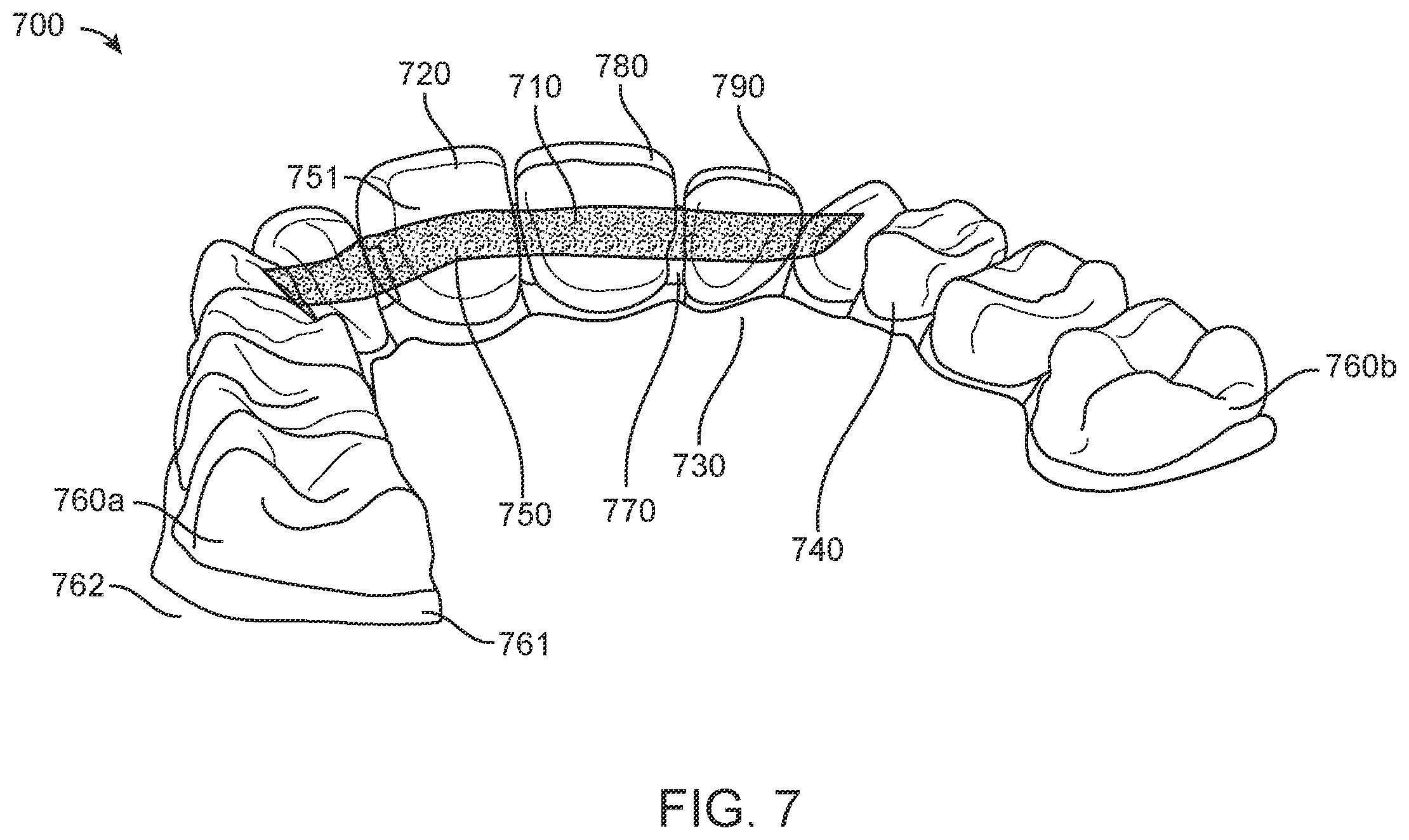 Patent US12588978 Figure 10 – Devices, systems, and methods for dental arch expansion