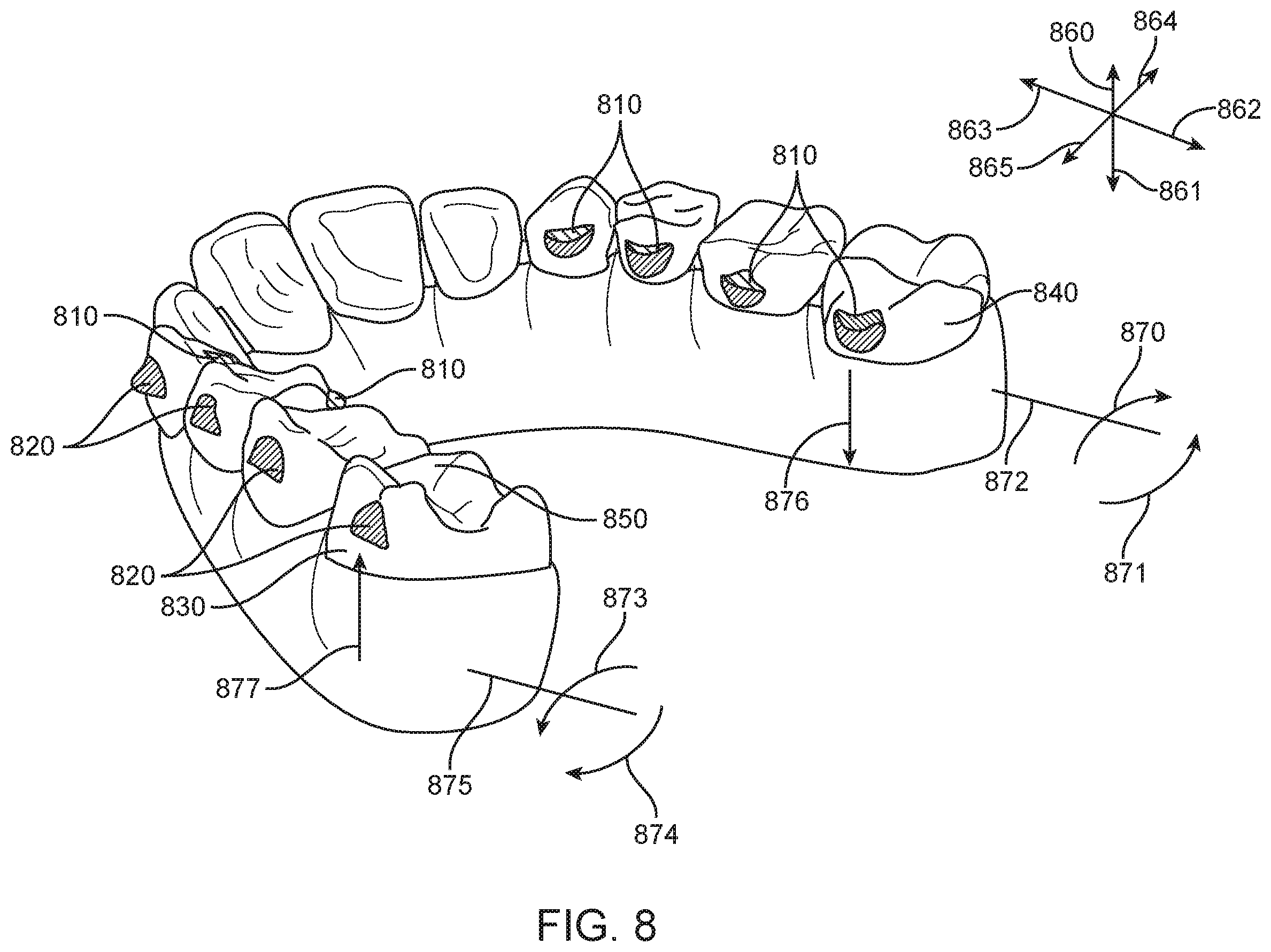 Patent US12588978 Figure 11 – Devices, systems, and methods for dental arch expansion