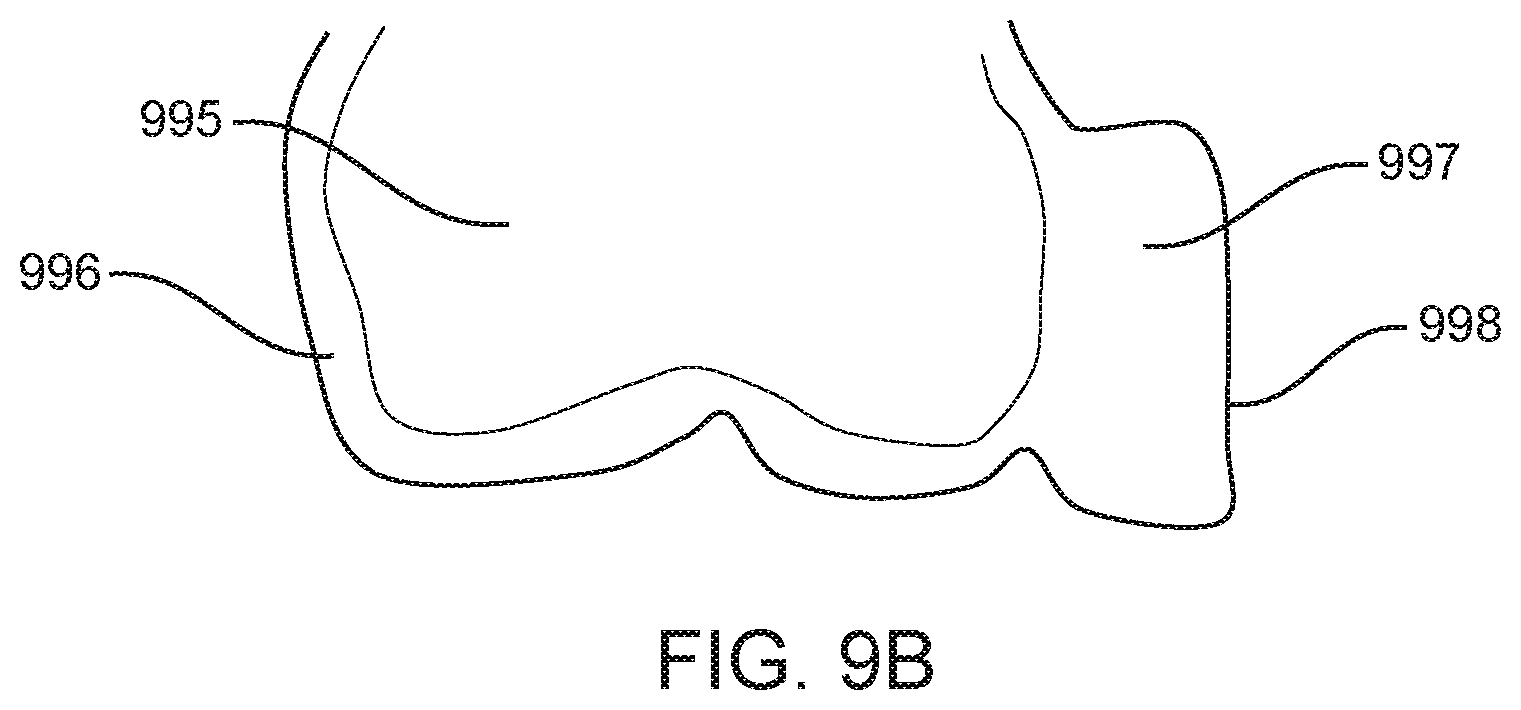 Patent US12588978 Figure 13 – Devices, systems, and methods for dental arch expansion