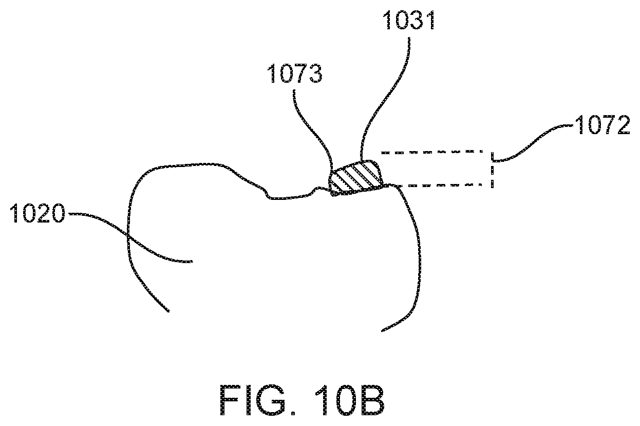 Patent US12588978 Figure 15 – Devices, systems, and methods for dental arch expansion