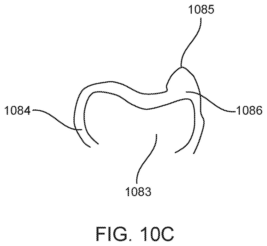Patent US12588978 Figure 16 – Devices, systems, and methods for dental arch expansion