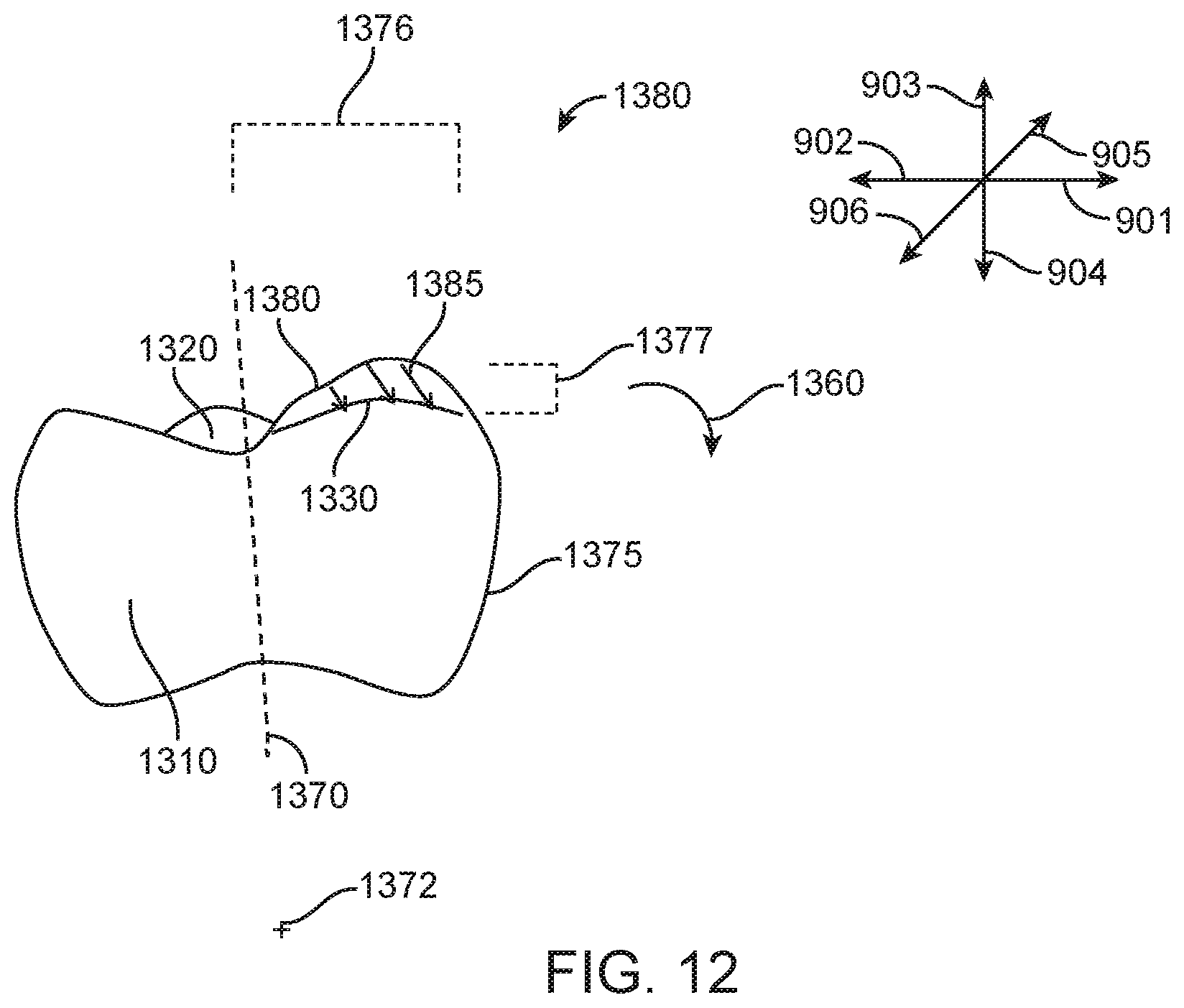 Patent US12588978 Figure 19 – Devices, systems, and methods for dental arch expansion