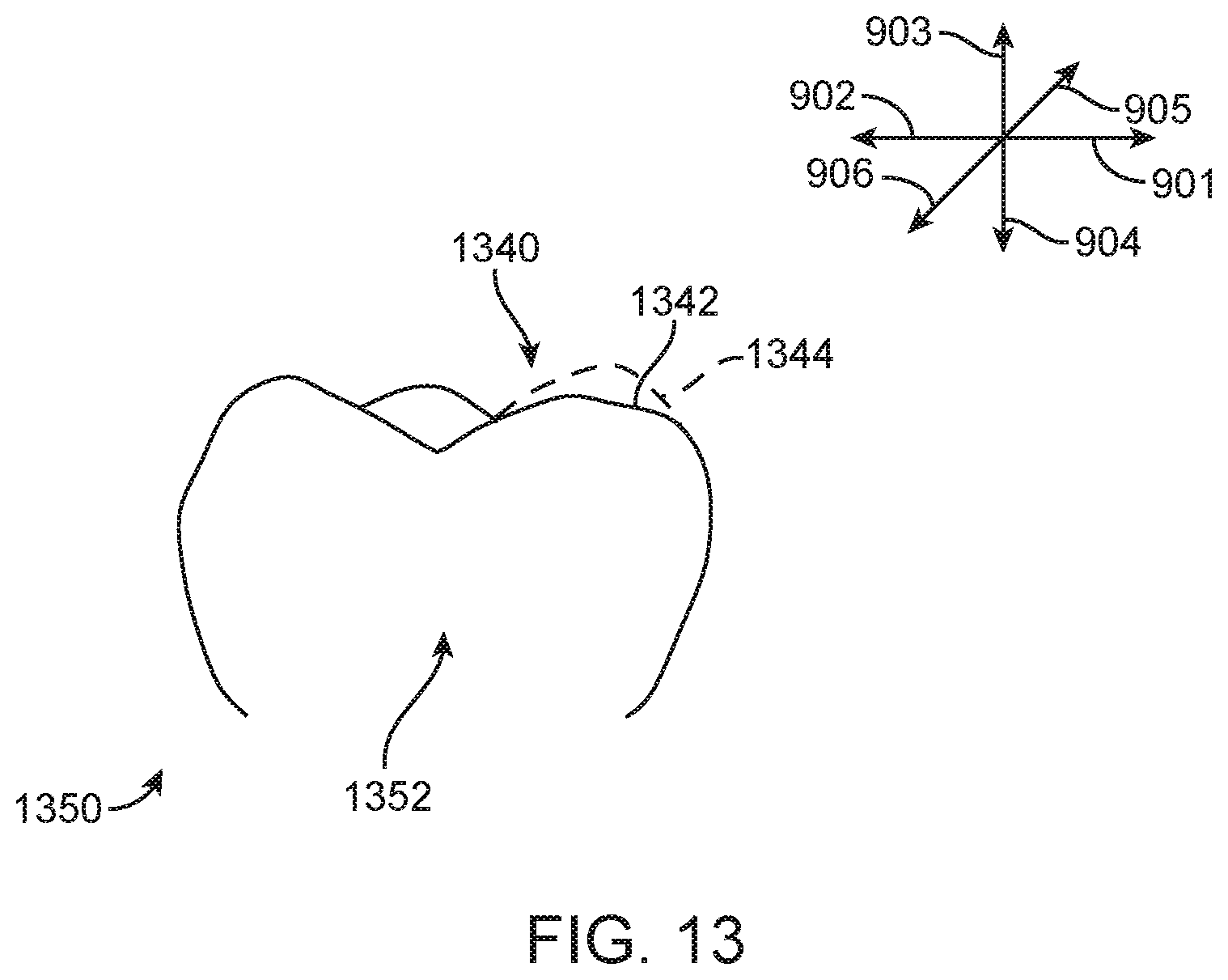 Patent US12588978 Figure 20 – Devices, systems, and methods for dental arch expansion