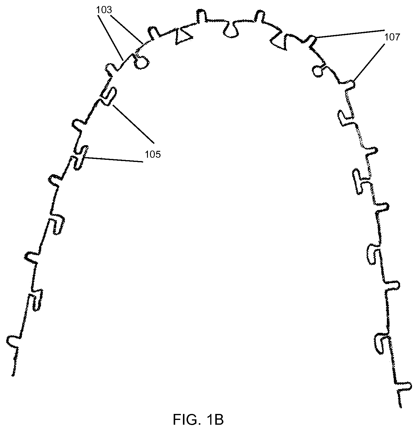 Patent US12588980 Figure 2 – Orthodontic appliance with snap fitted, non-sliding archwire