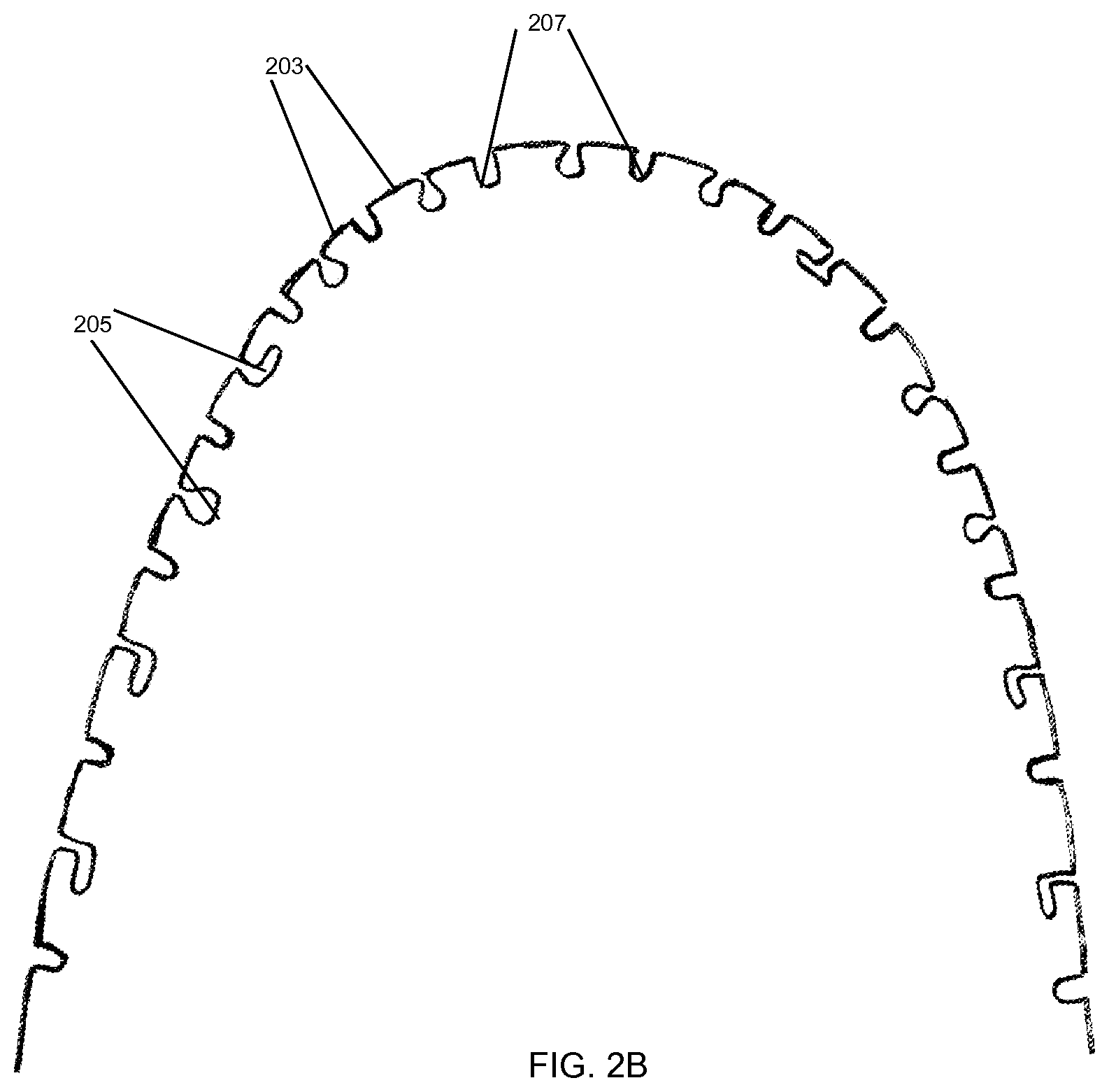 Patent US12588980 Figure 4 – Orthodontic appliance with snap fitted, non-sliding archwire
