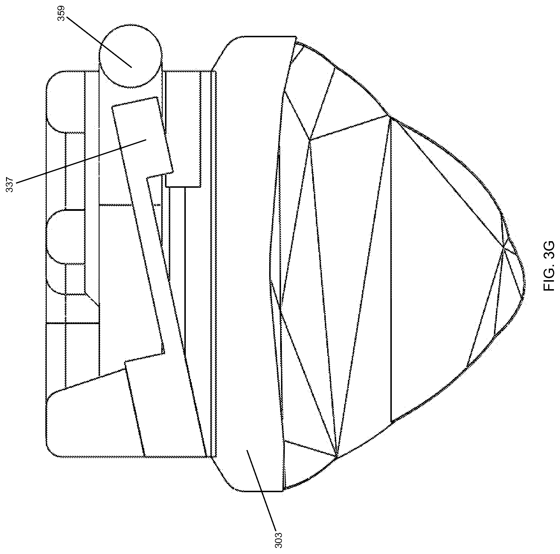 Patent US12588980 Figure 11 – Orthodontic appliance with snap fitted, non-sliding archwire