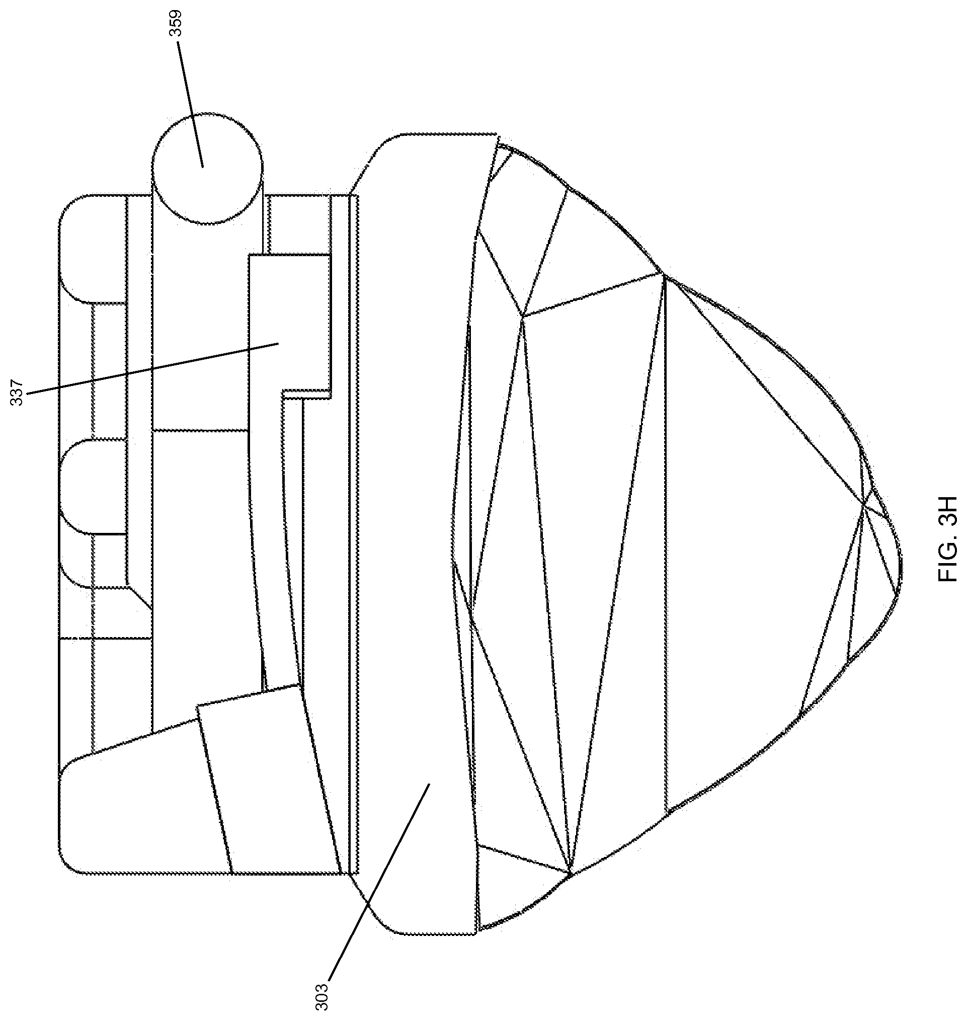 Patent US12588980 Figure 12 – Orthodontic appliance with snap fitted, non-sliding archwire
