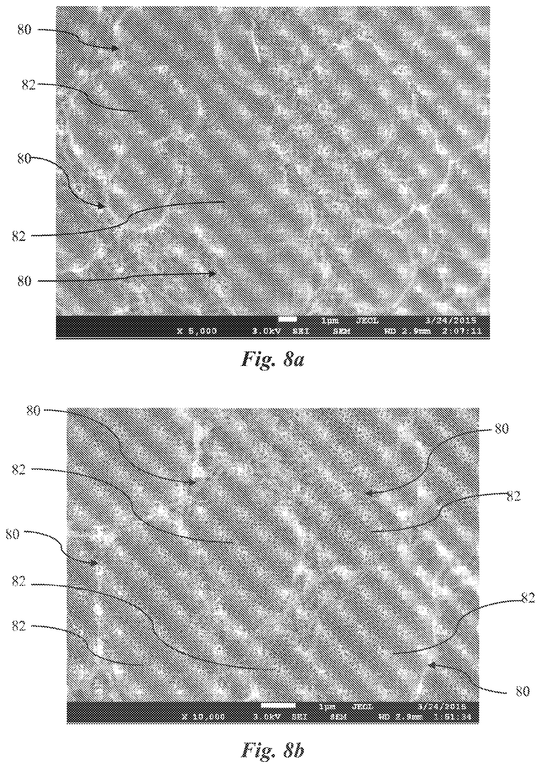 Patent US12588981 Figure 8 – Surface treatment for an implant surface