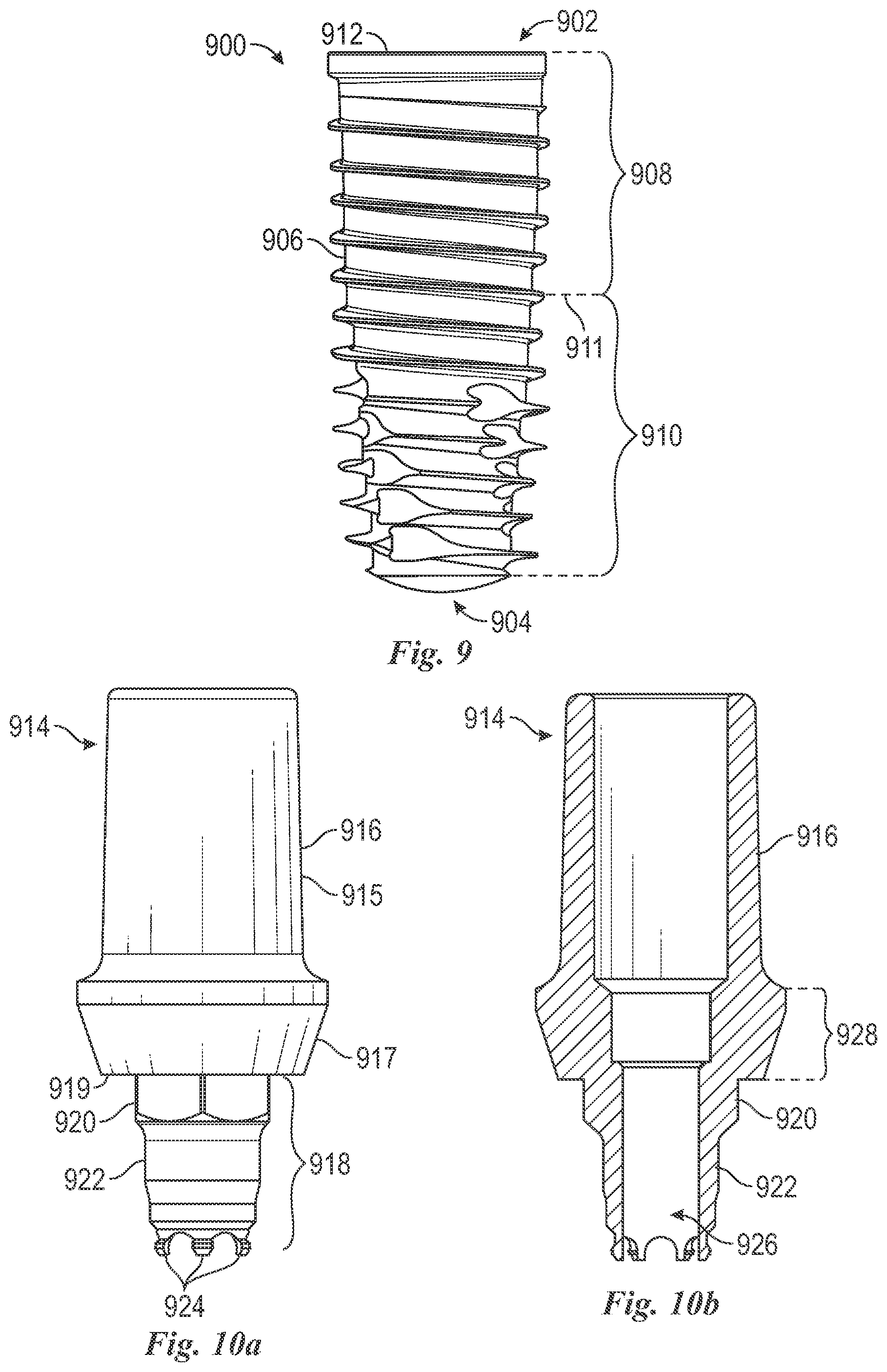 Patent US12588981 Figure 10 – Surface treatment for an implant surface