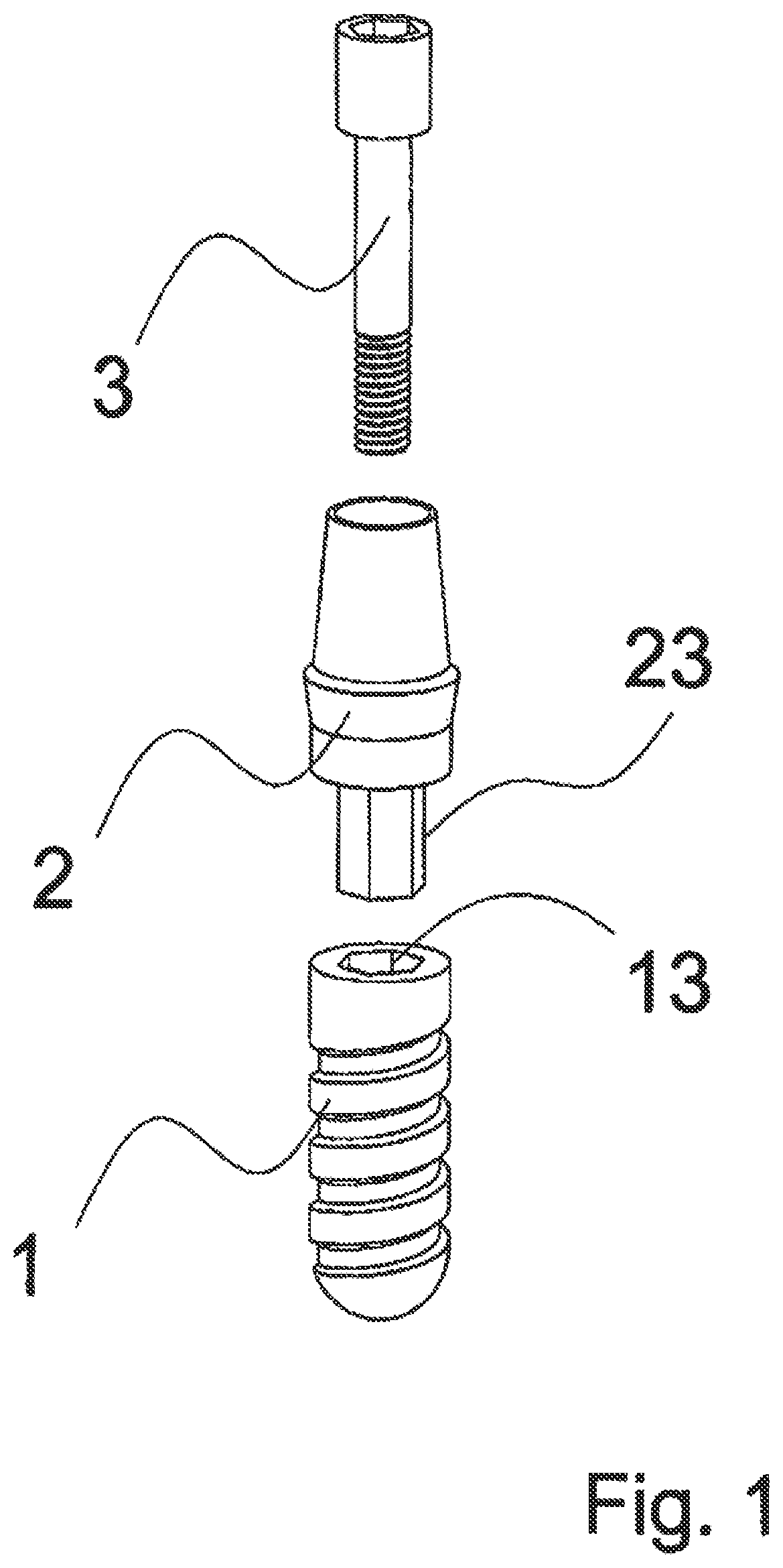 Patent US12588983 — Dental implant with indexing surfaces having a friction-reducing coating — Figure 1