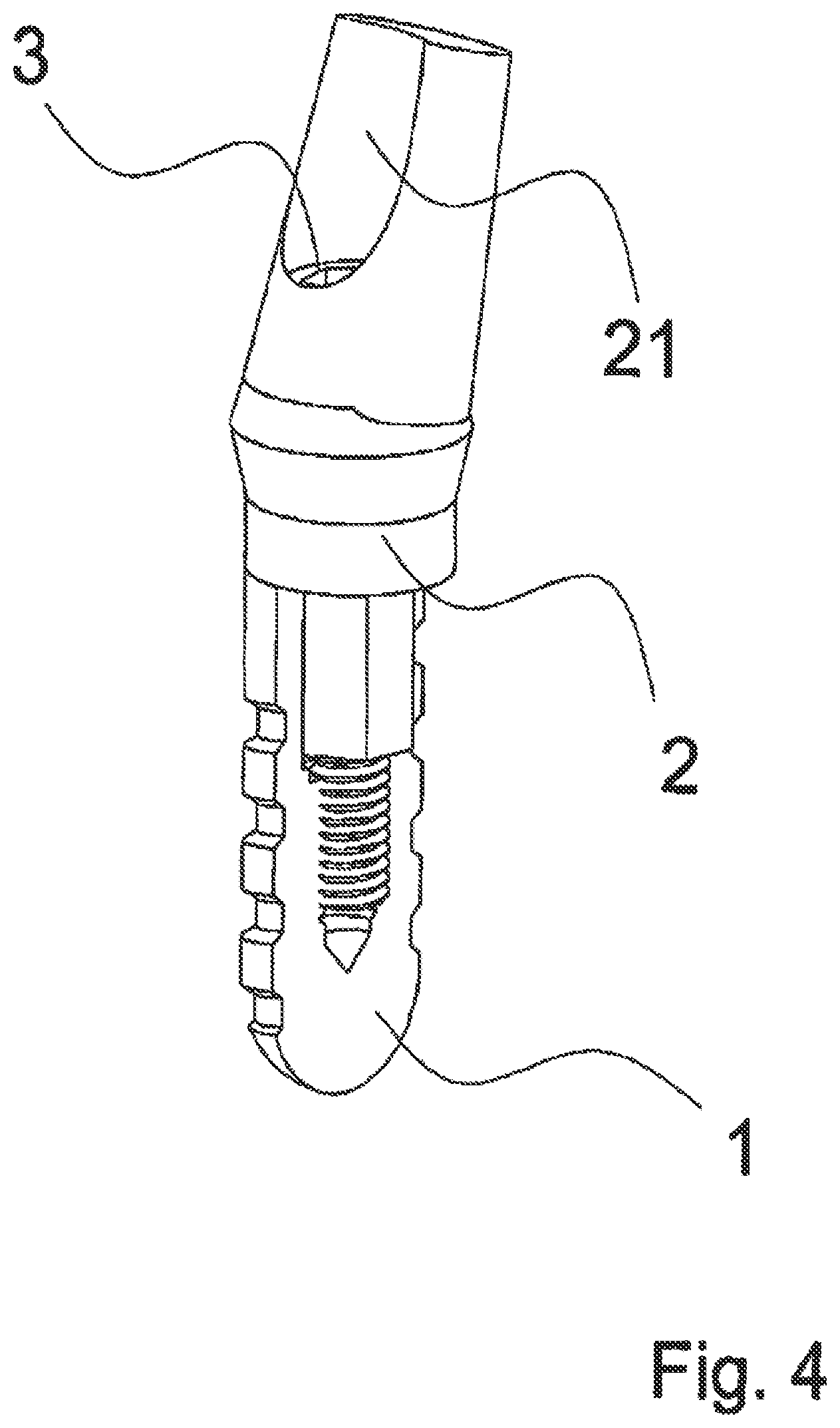 Patent US12588983 Figure 4 – Dental implant with indexing surfaces having a friction-reducing coating