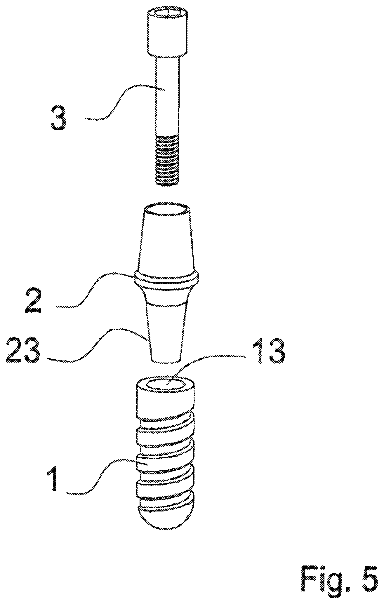 Patent US12588983 Figure 5 – Dental implant with indexing surfaces having a friction-reducing coating