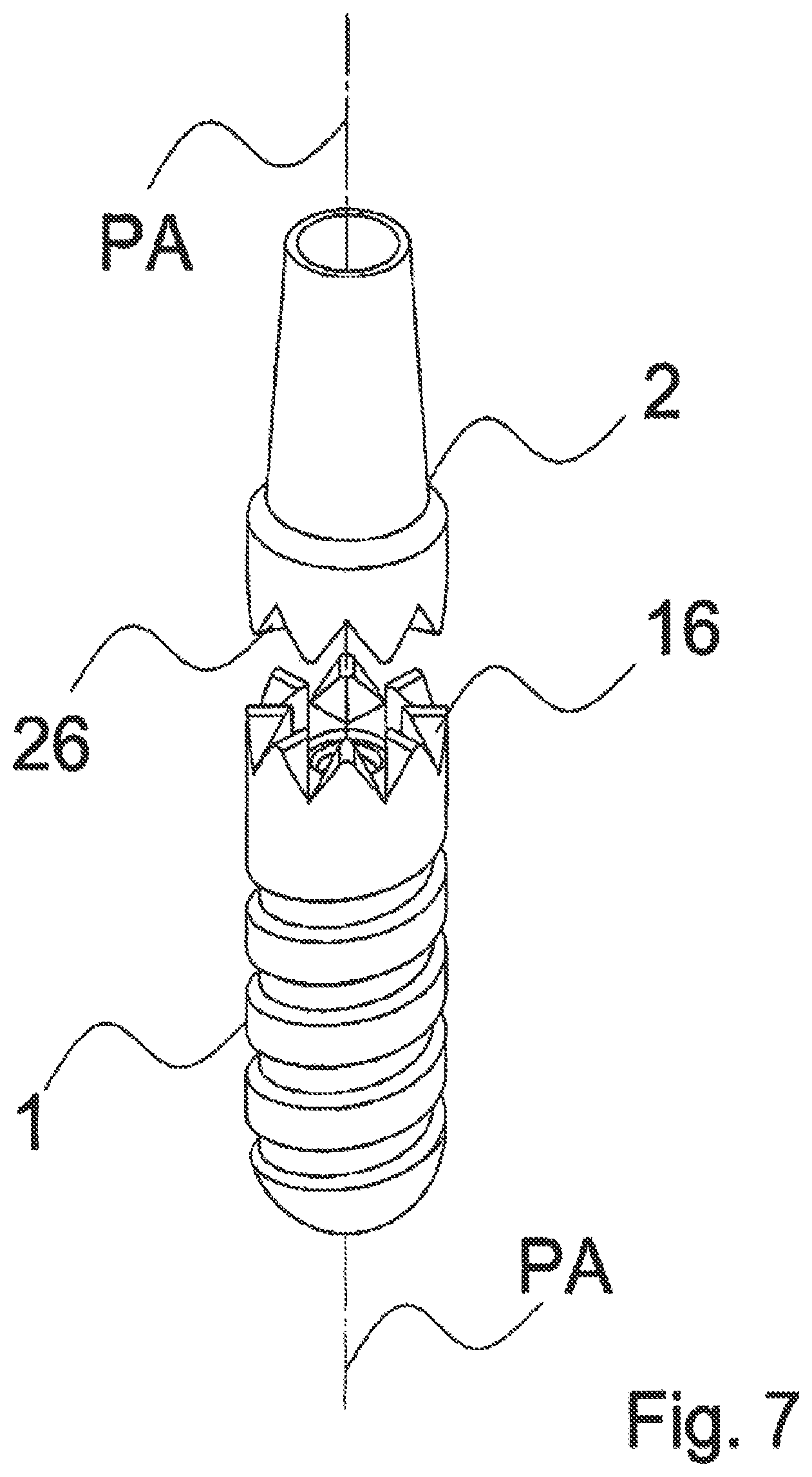 Patent US12588983 Figure 7 – Dental implant with indexing surfaces having a friction-reducing coating