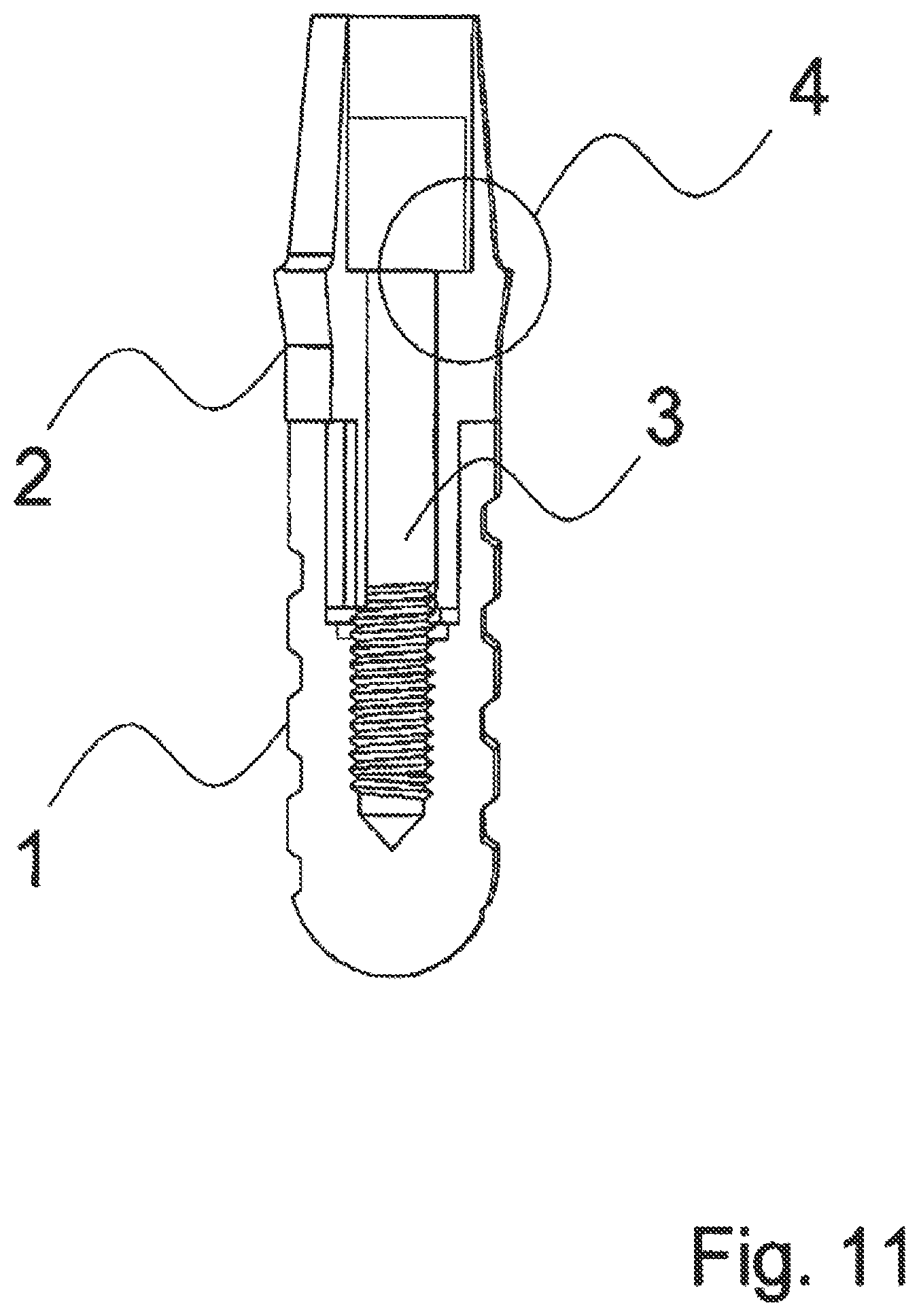 Patent US12588983 Figure 11 – Dental implant with indexing surfaces having a friction-reducing coating