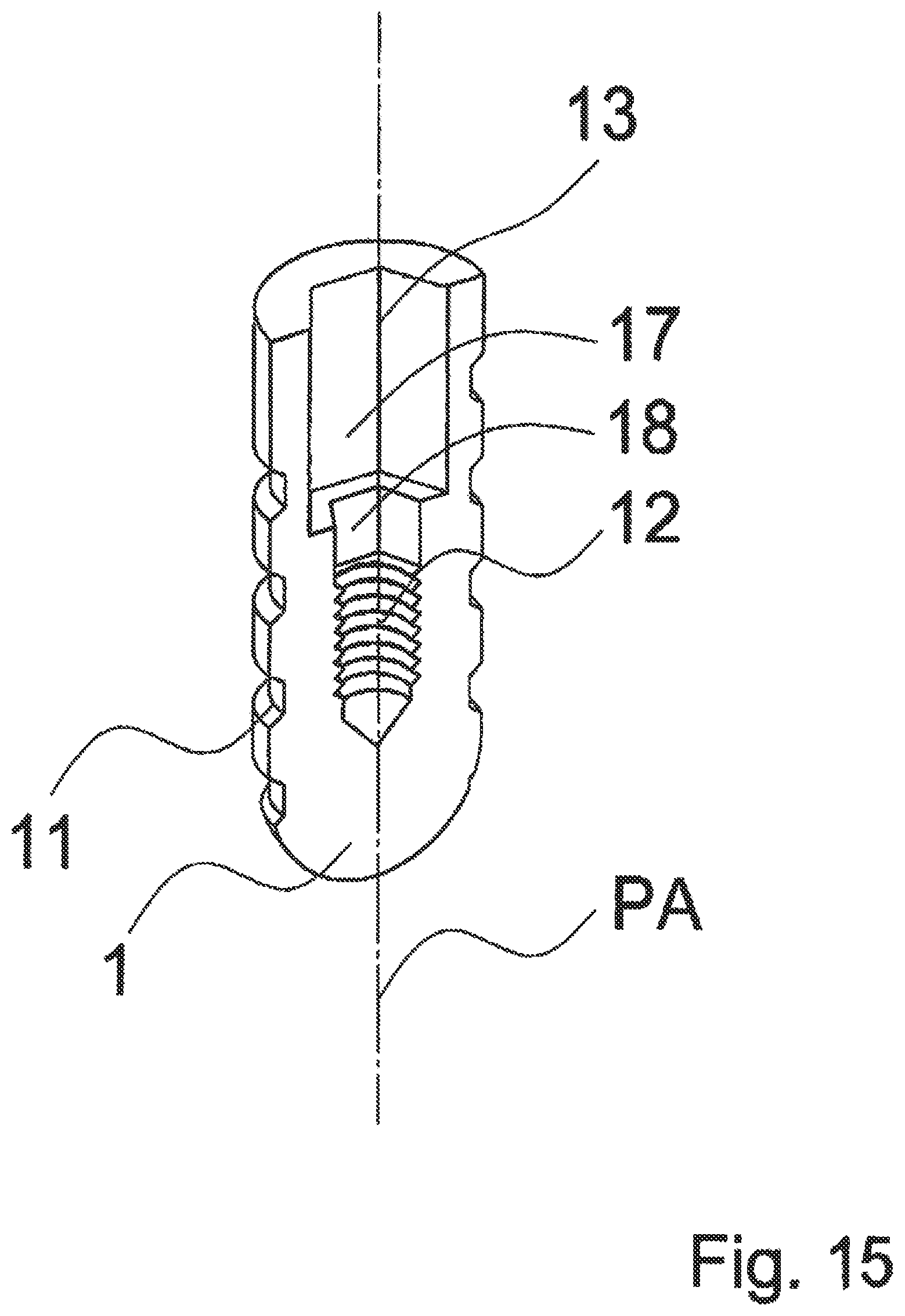 Patent US12588983 Figure 15 – Dental implant with indexing surfaces having a friction-reducing coating