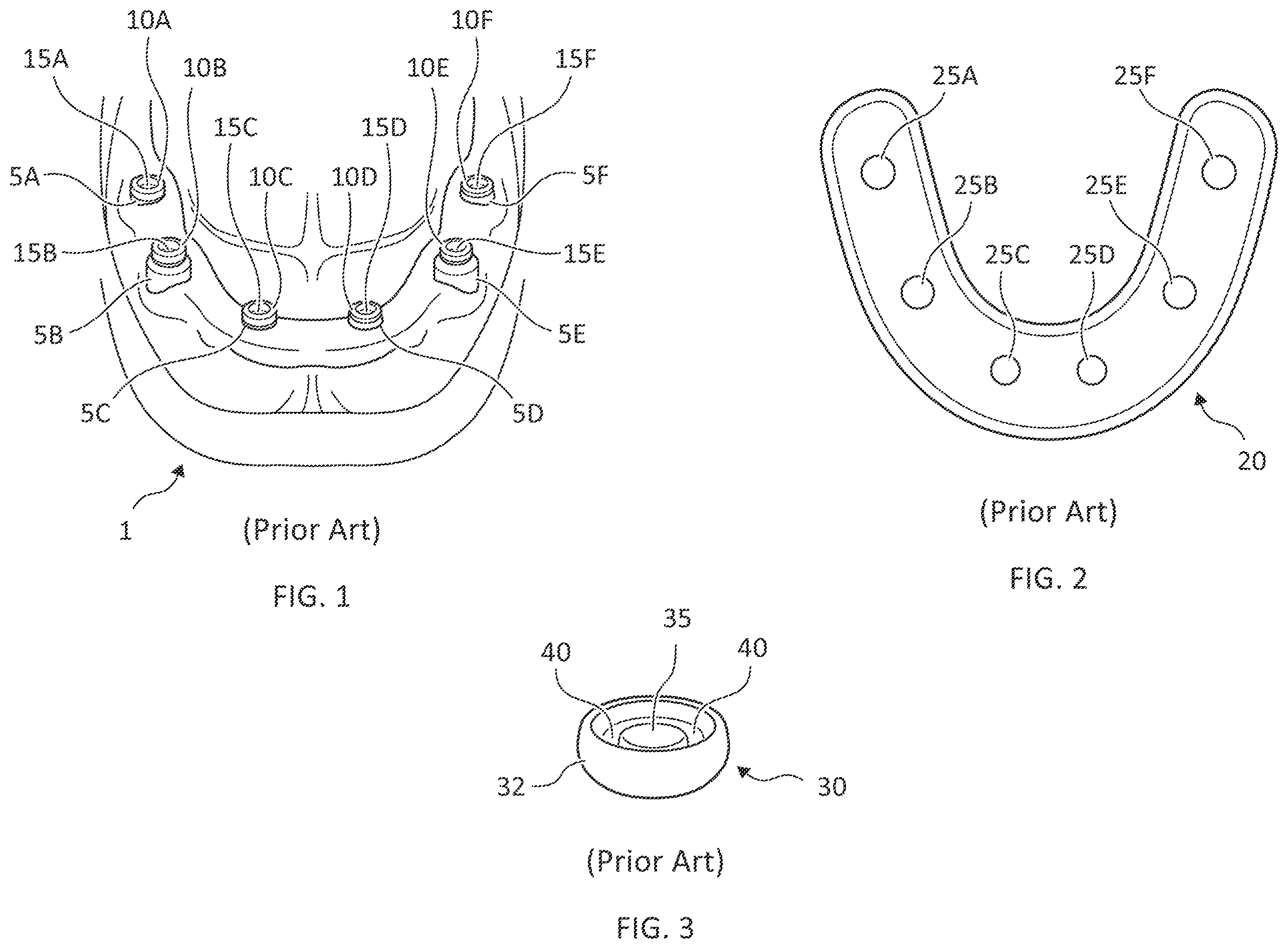 Patent US12588984 Figure 1 – Dental apparatus and methods