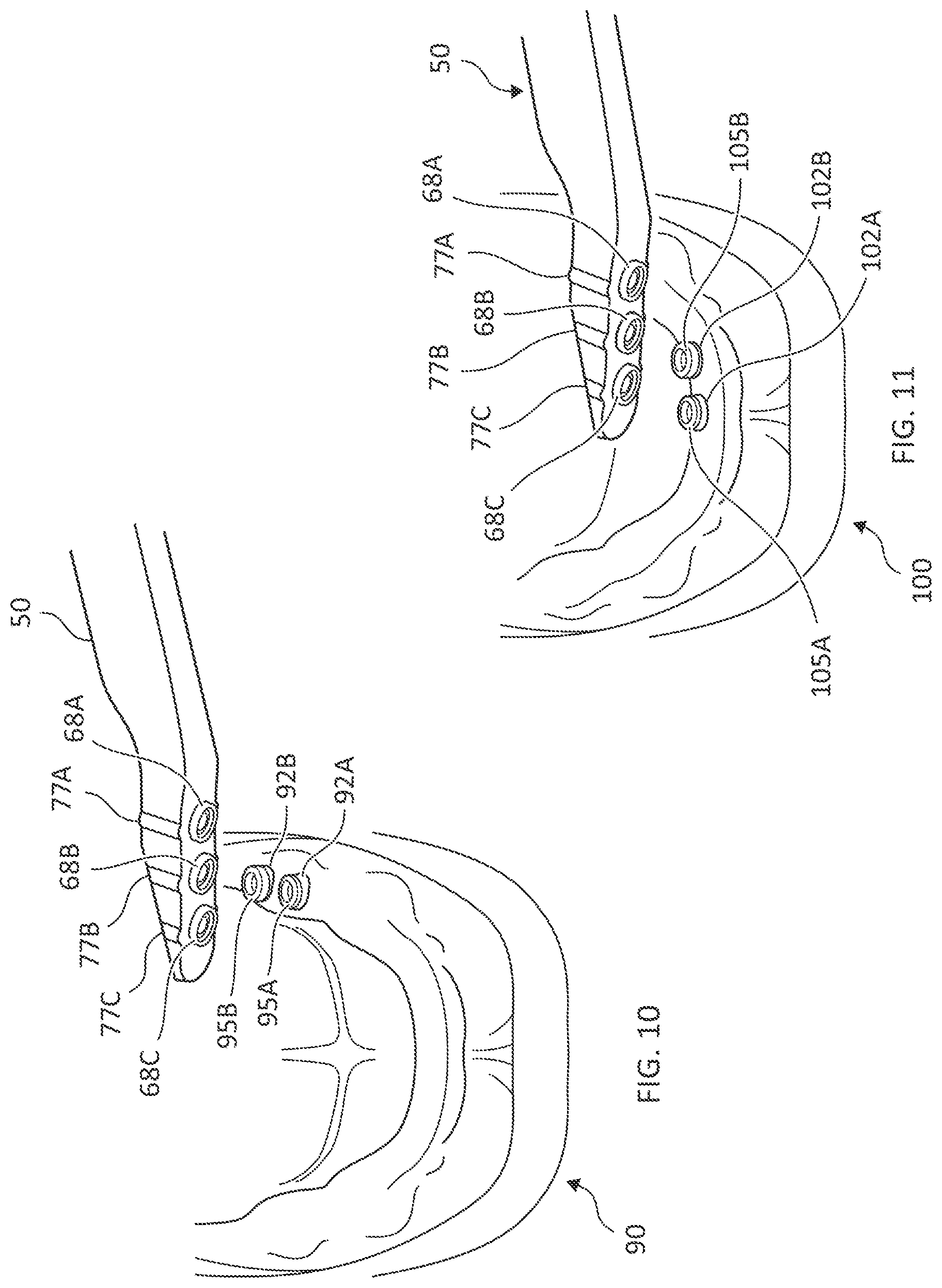 Patent US12588984 Figure 5 – Dental apparatus and methods