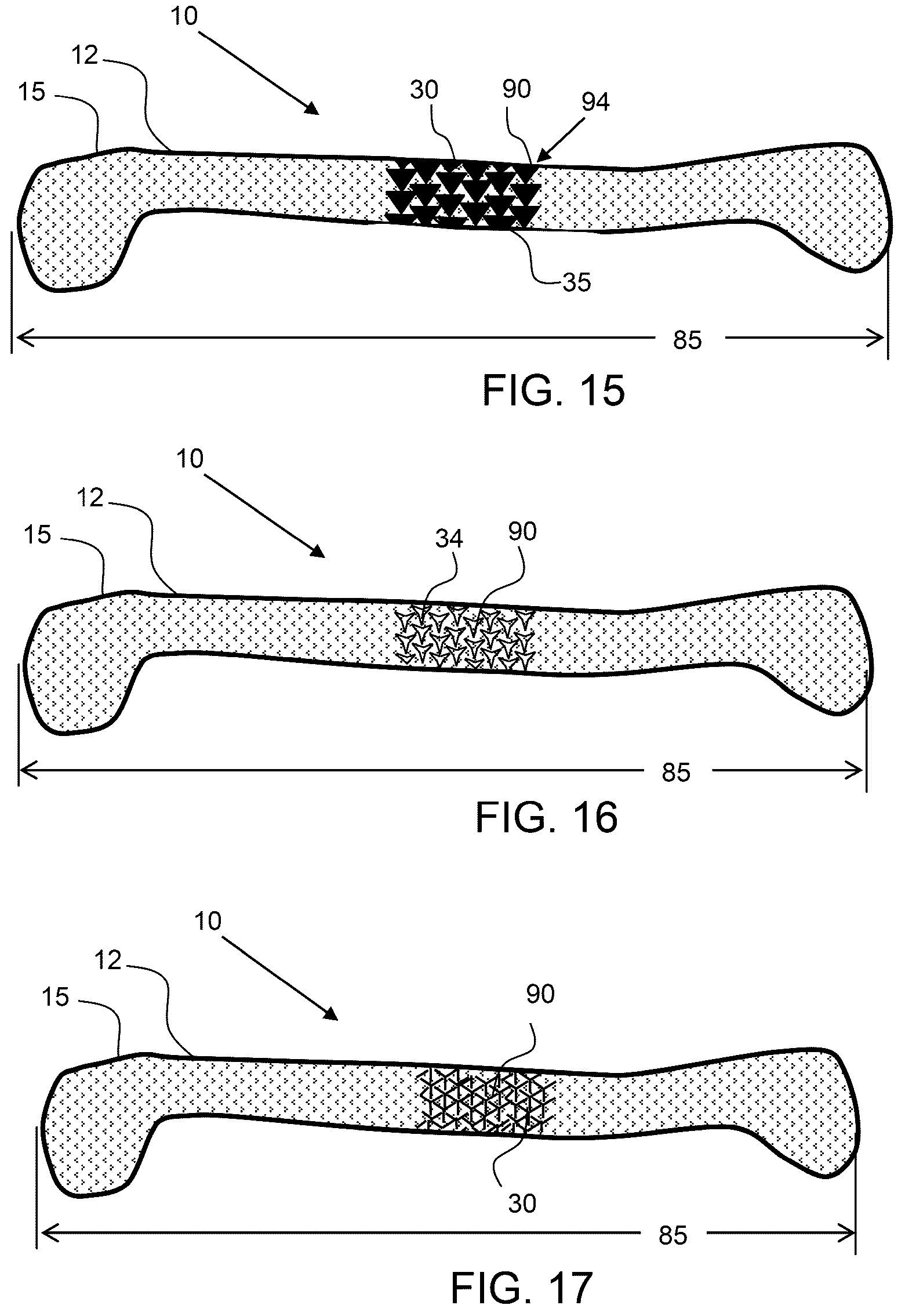 Patent US12588985 Figure 7 – Compliant biological scaffold