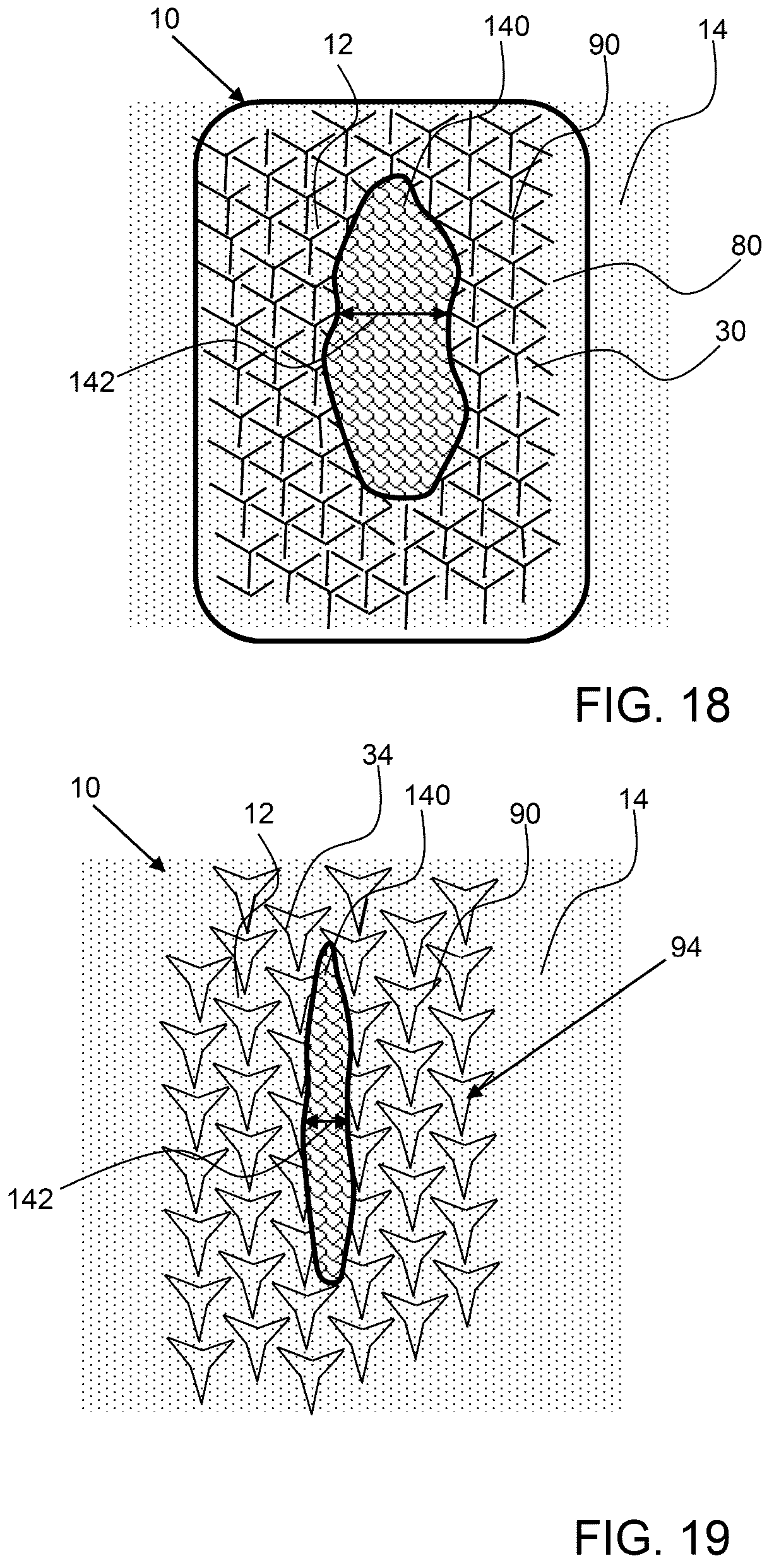 Patent US12588985 Figure 8 – Compliant biological scaffold